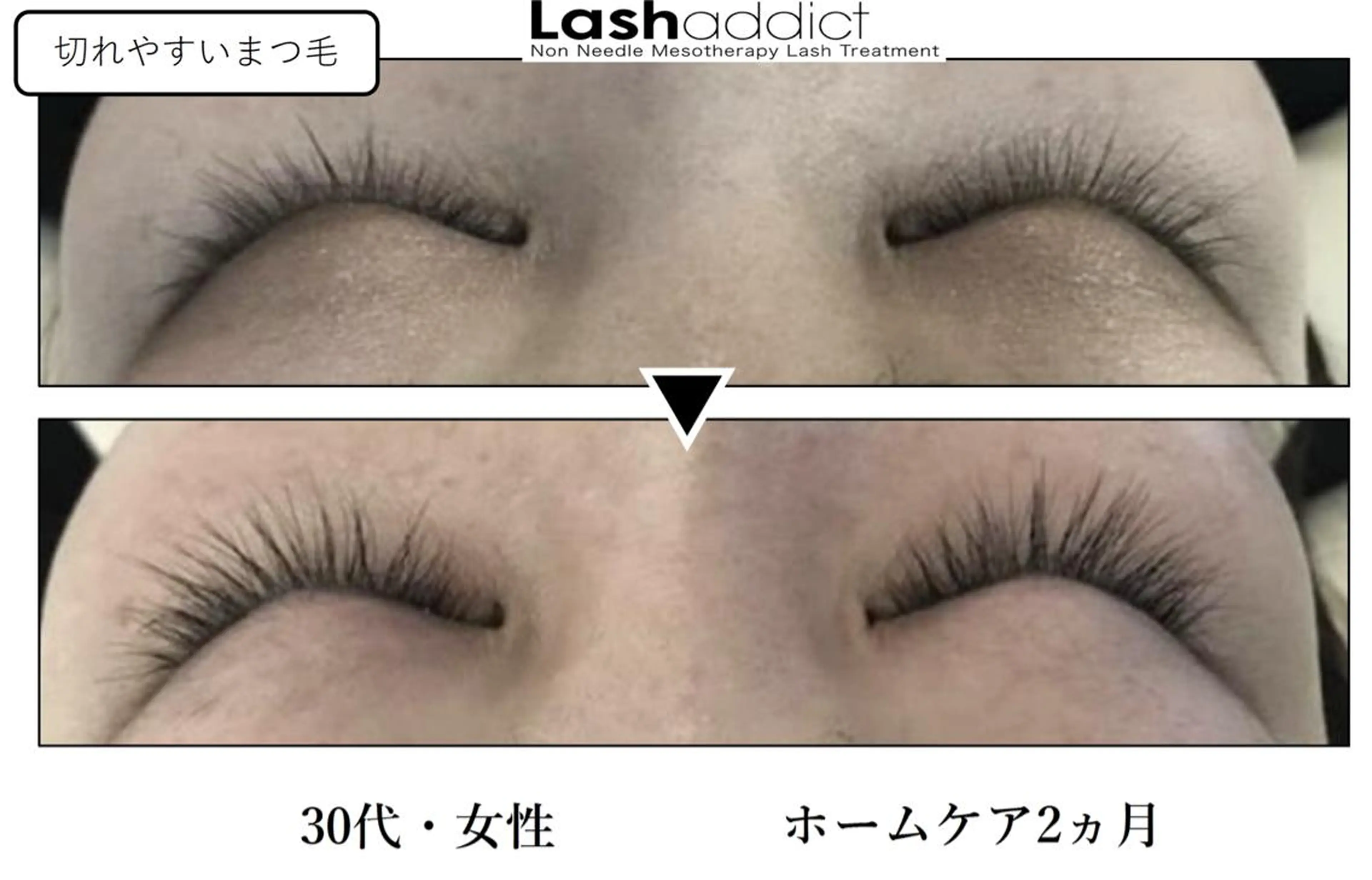 マツエク・マツパ アイブロウ ♾nail 恵美のマツエク・マツパデザイン