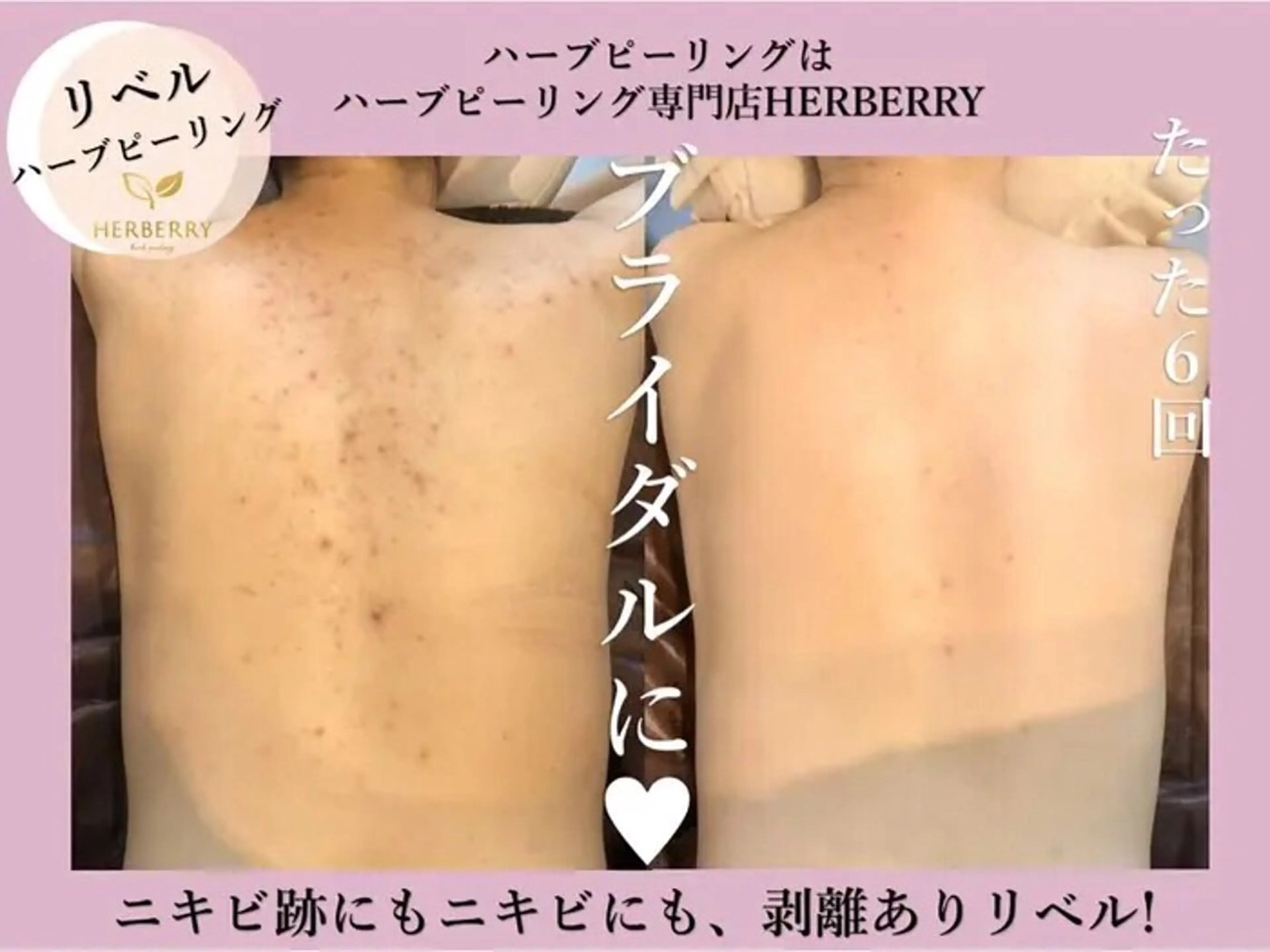 ハーブピーリング専門店HERBERRY難波心斎橋店所属・ハーブピーリング専門 HERBERRY冨永のエステ・リラクイメージ