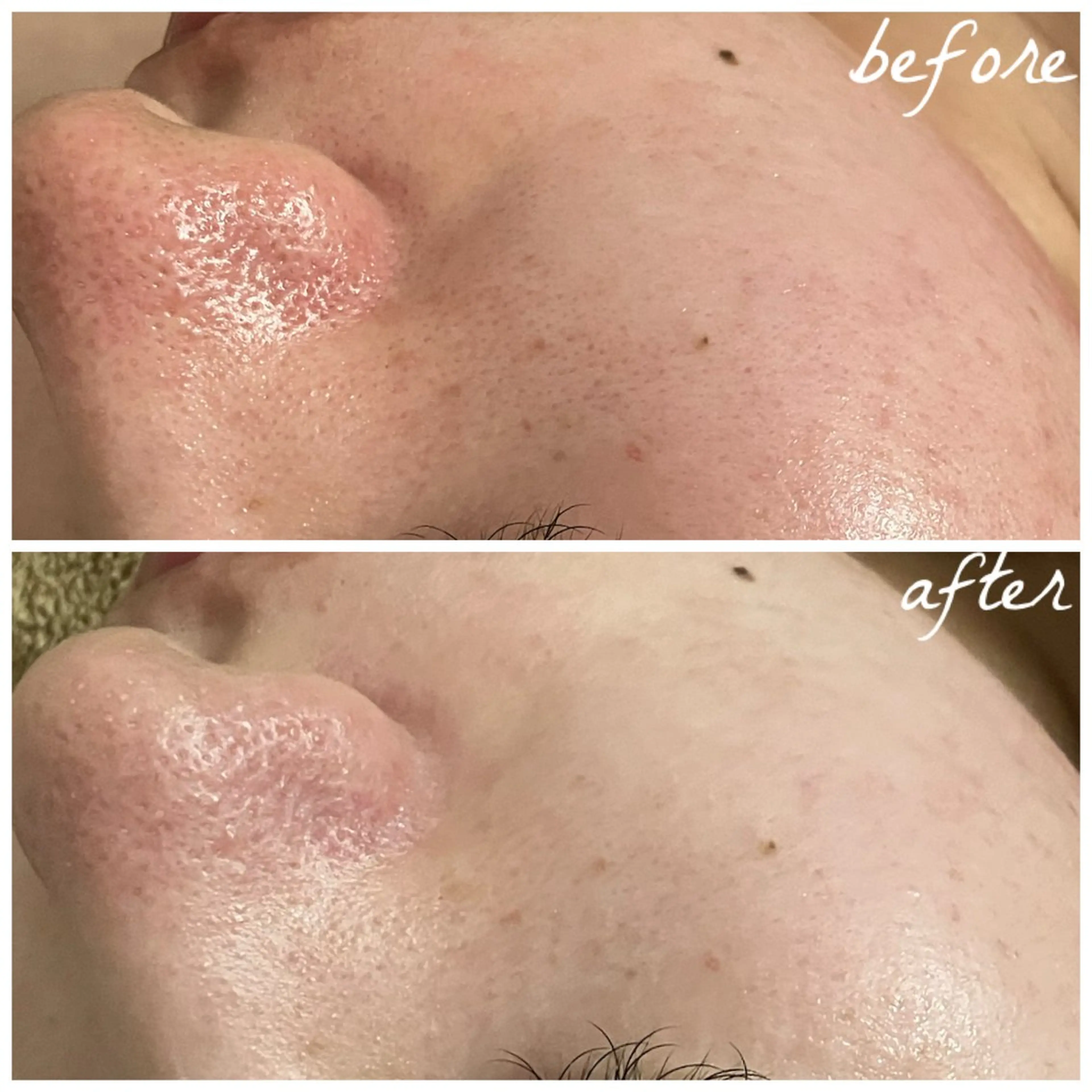 メンズ エステ メナード岐阜茜部 杉浦のエステ・リラクイメージ