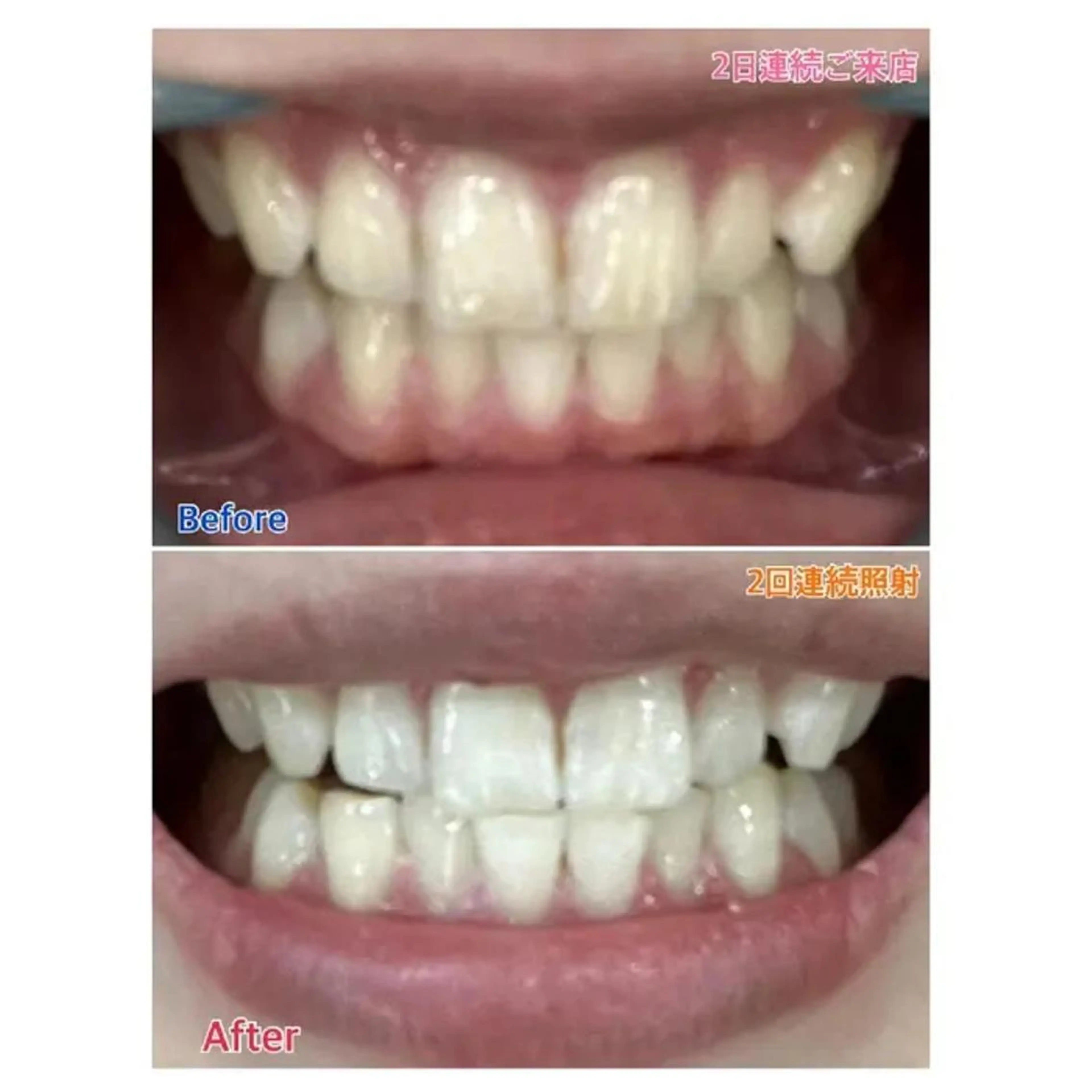 M渋谷店所属・Ｍ渋谷 ホワイトニングのその他イメージ