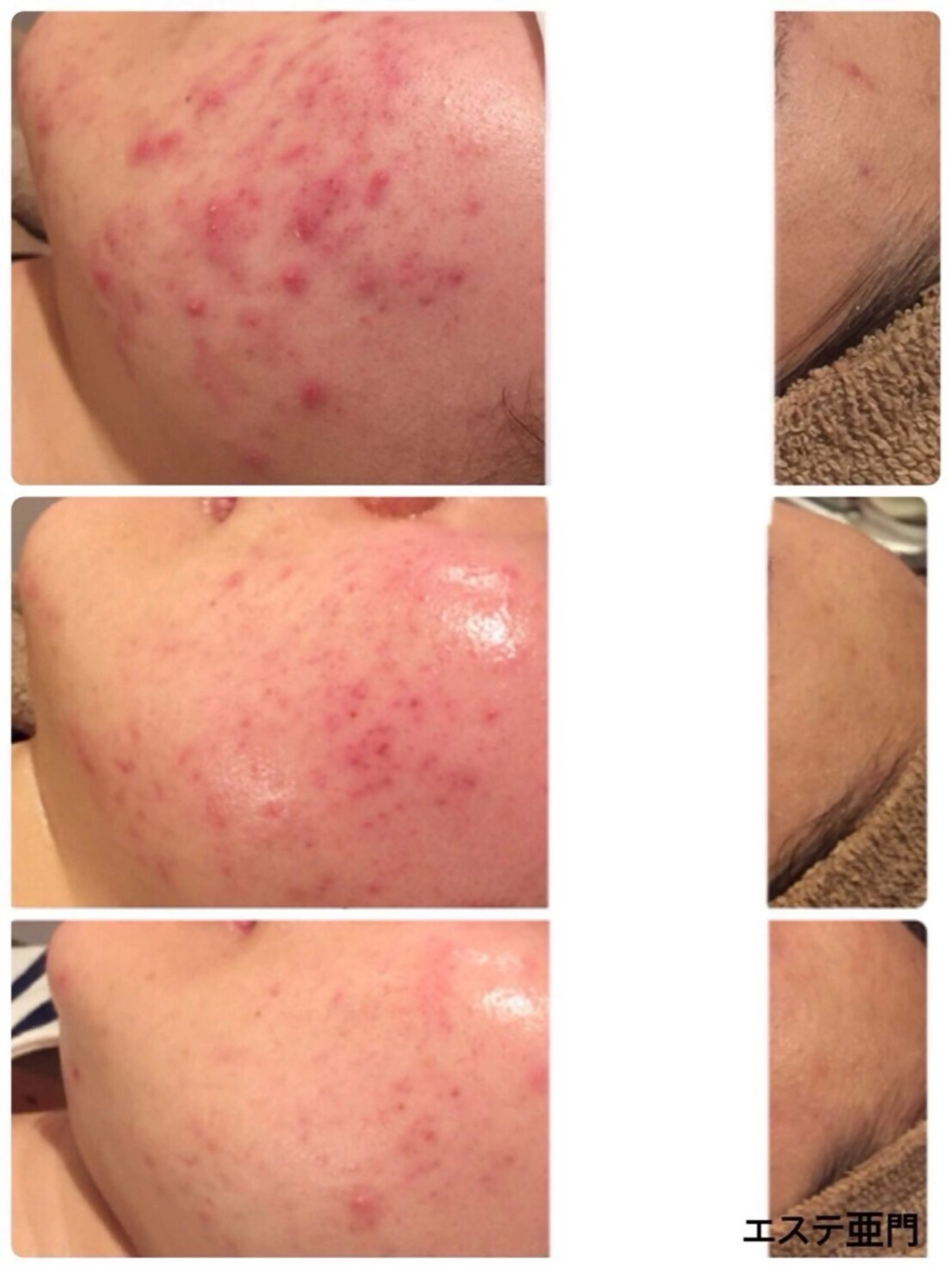 石井 つかさのエステ・リラクイメージ