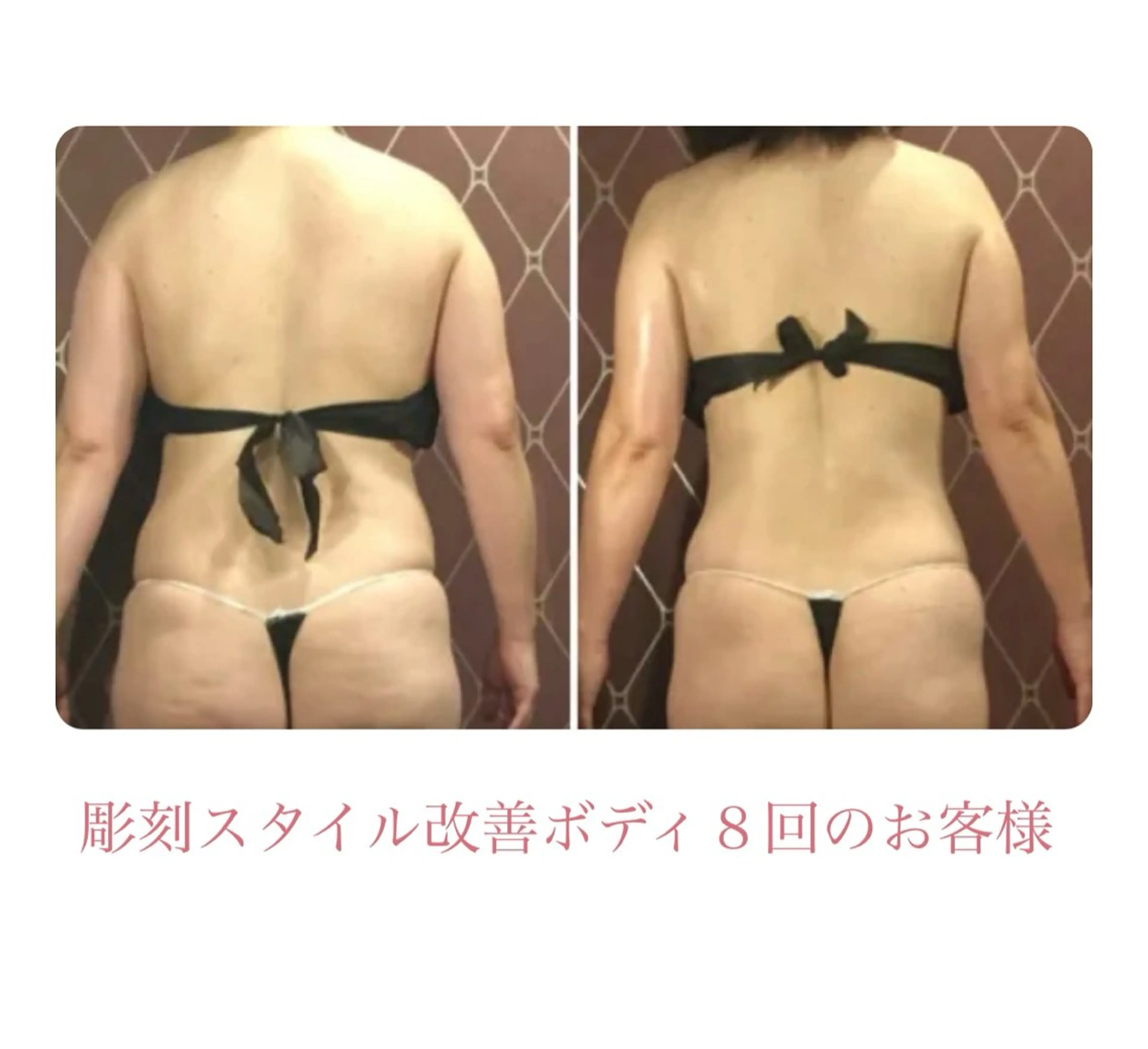 DEA  LUCE所属・痩身&小顔エステ DEA   LUCEのエステ・リラクイメージ