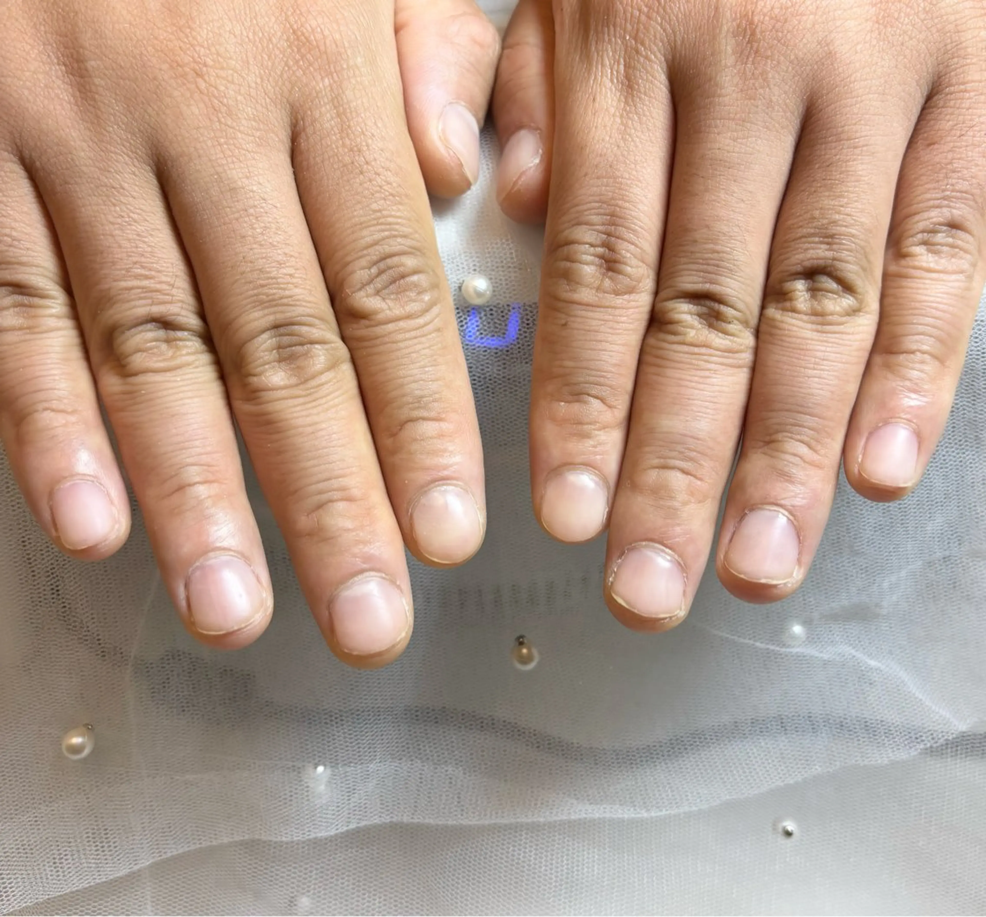 【深爪・噛み爪】の写真