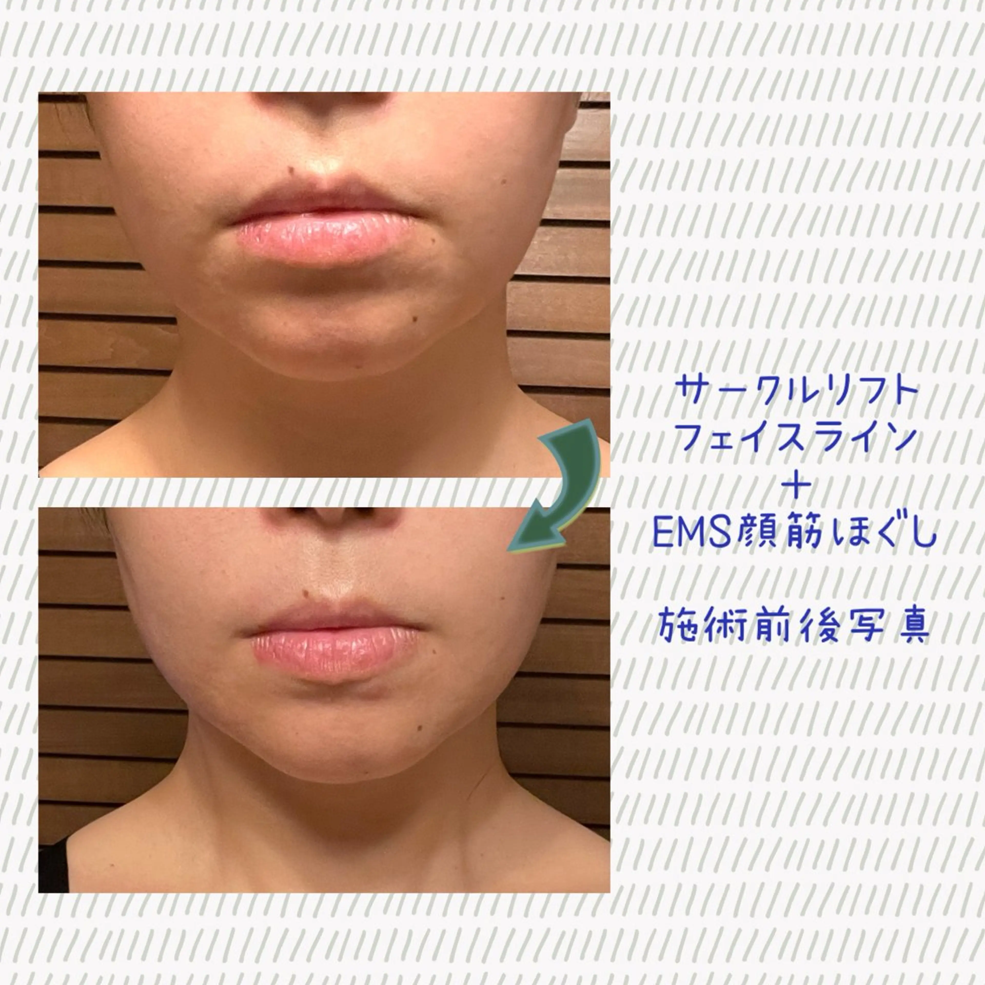 Laplace池袋本店(ラプラス池袋本店)所属・Laplace 池袋本店のその他イメージ