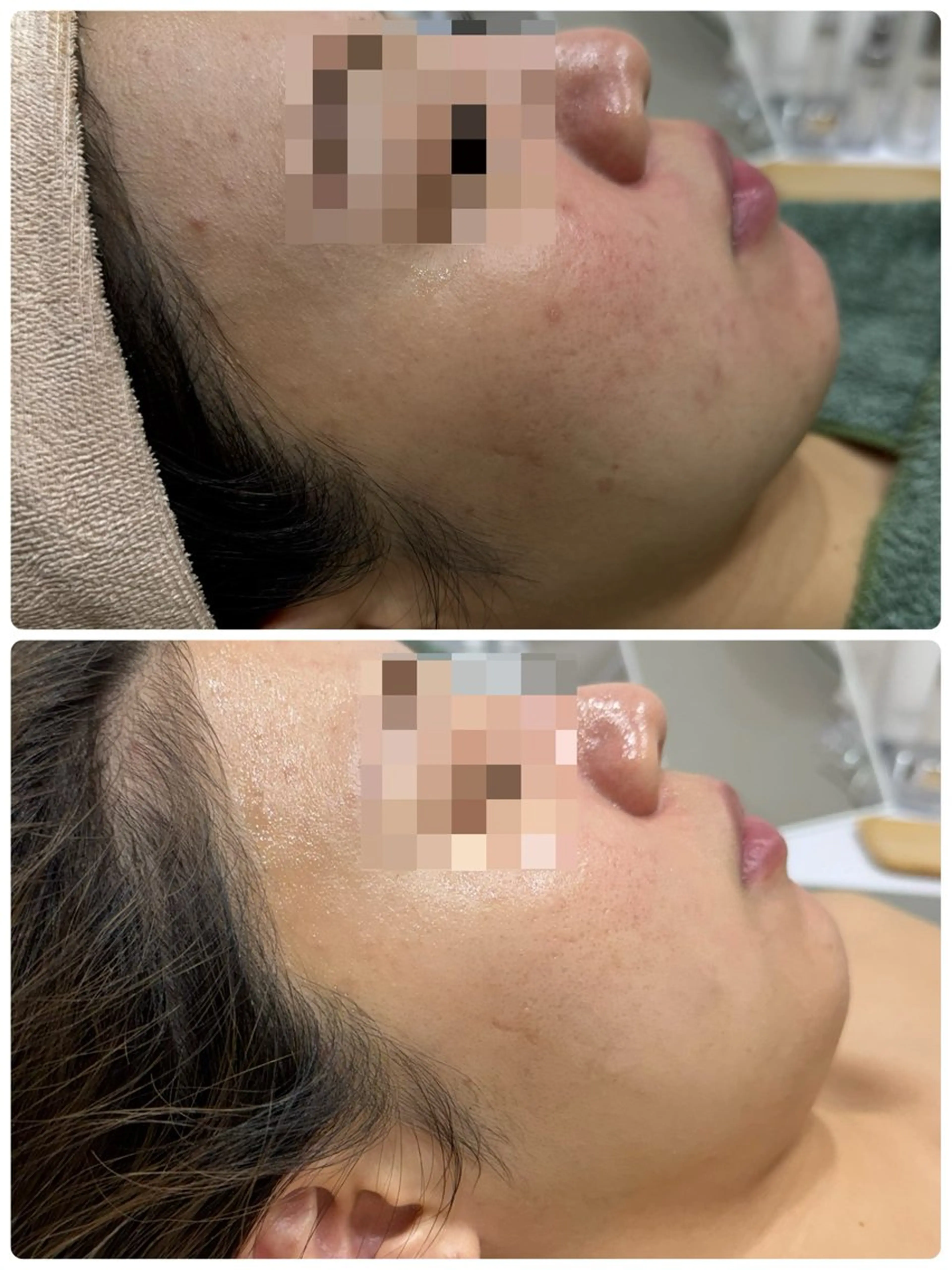 エステ 脱毛&フェイシャル 専門店muro.のエステ・リラクイメージ