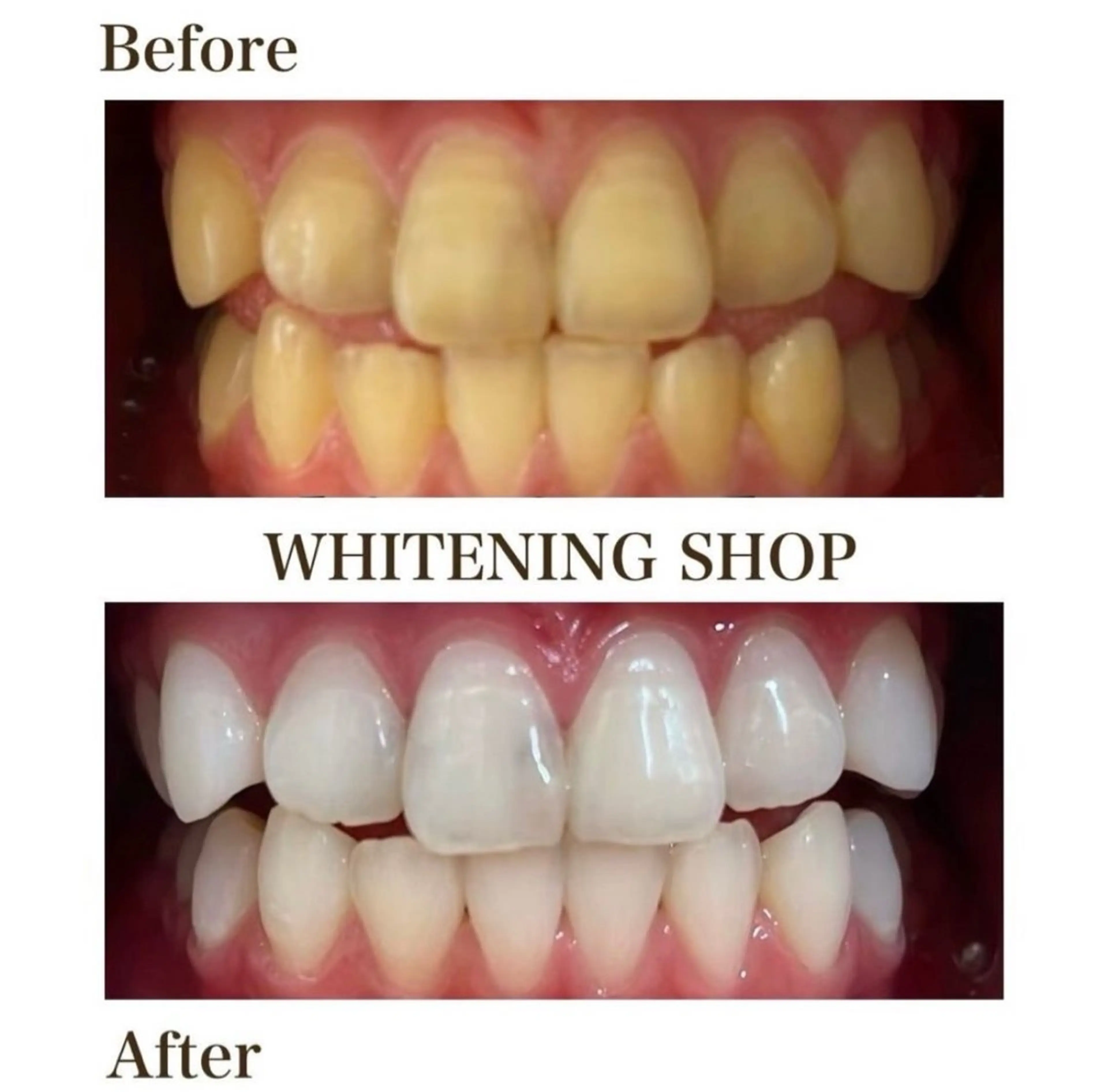 ホワイトニングショップ伊丹店所属・ホワイトニング ショップ伊丹店のその他イメージ