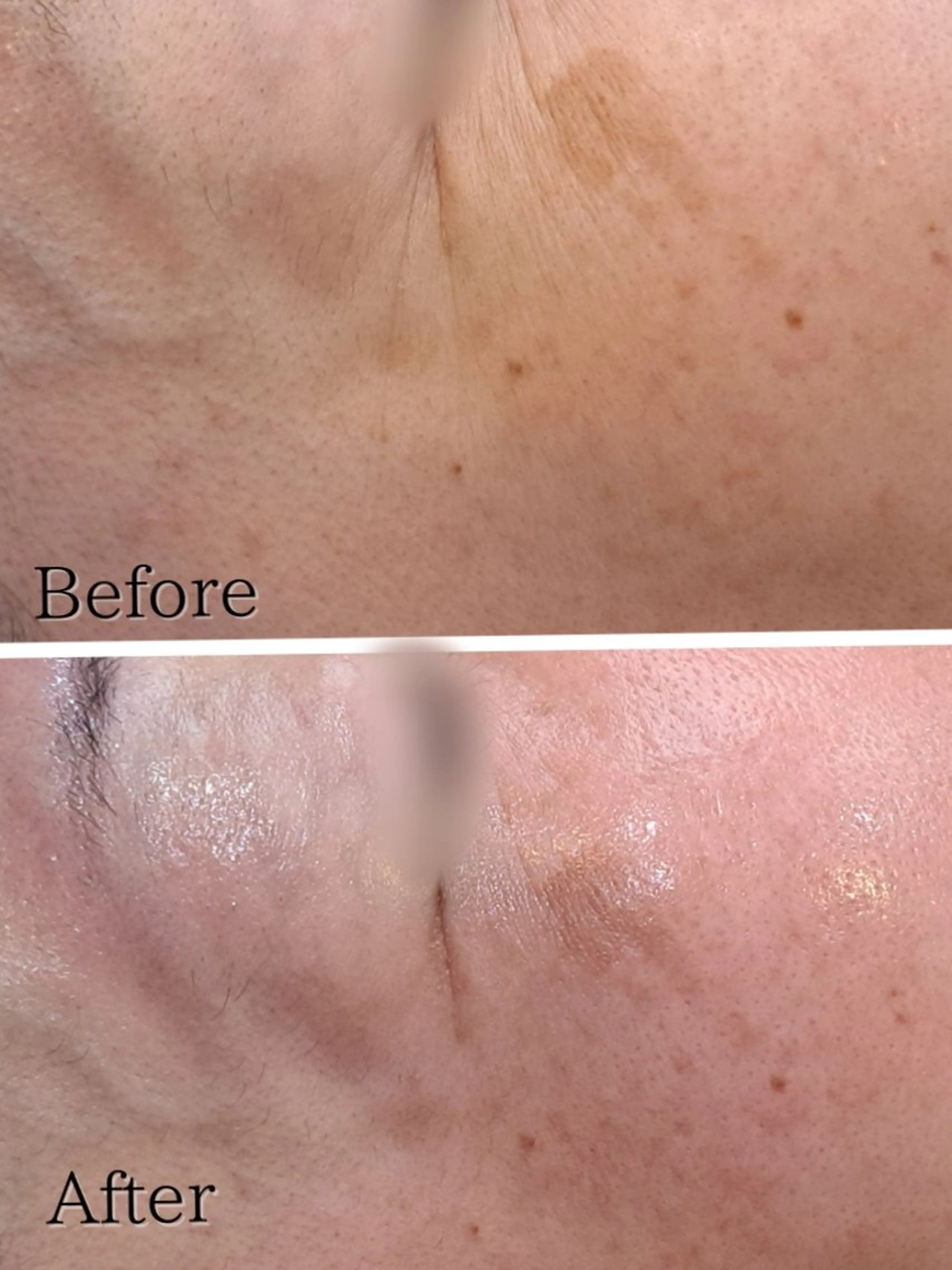 Hisui 種村のエステ・リラクイメージ