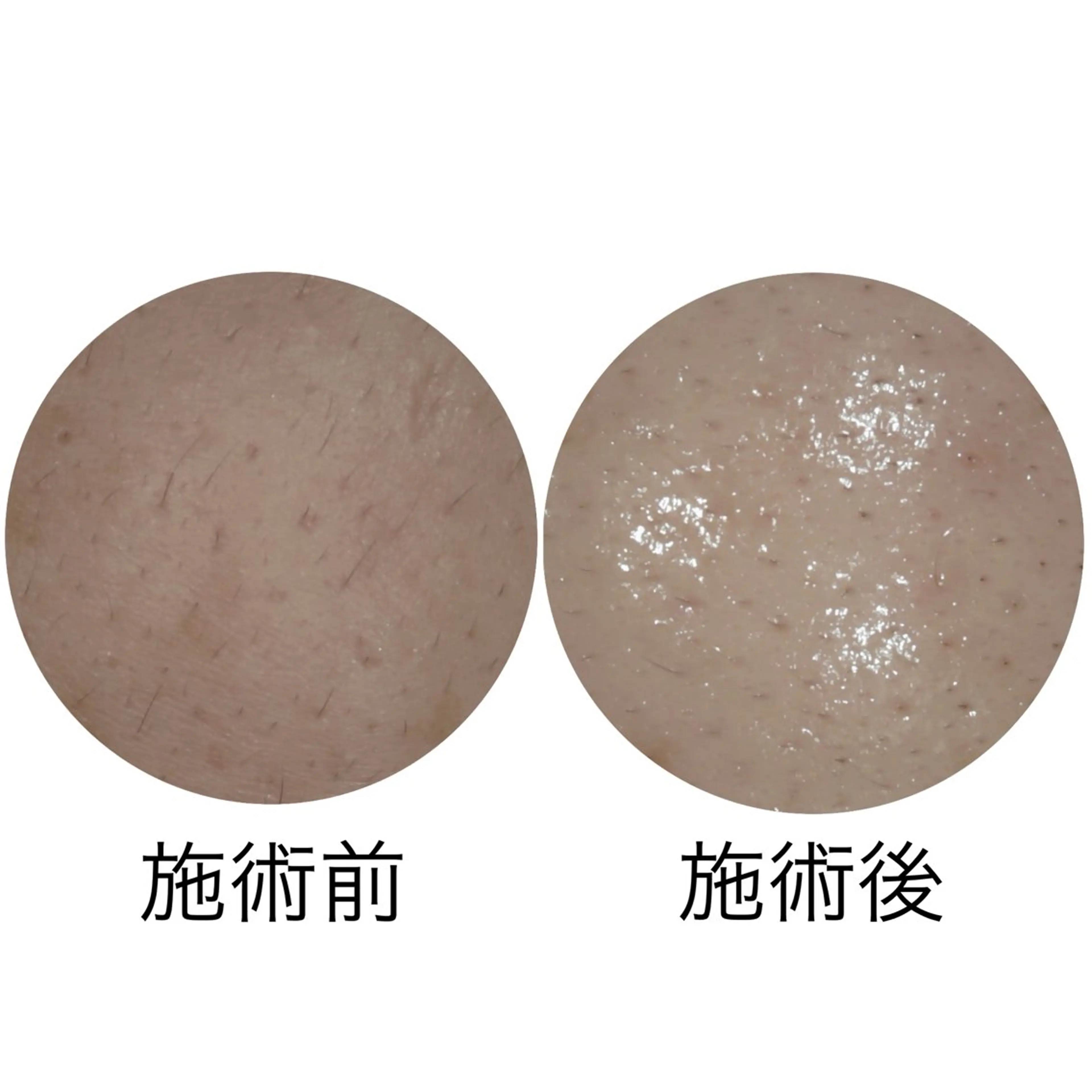 メナードフェイシャルサロン丸の内ヒルズ所属・メナード丸の内ヒルズ 柳田りさのエステ・リラクイメージ