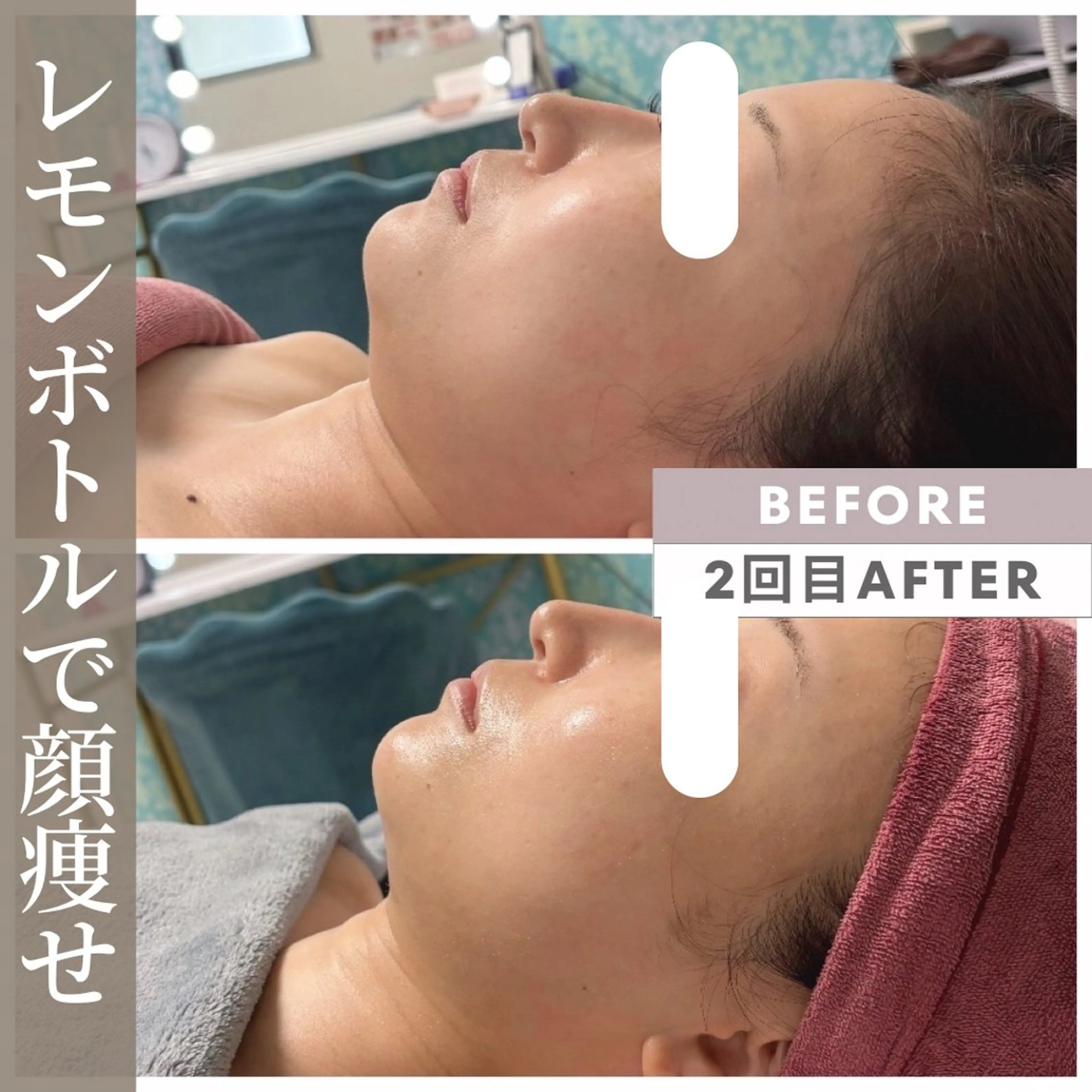 エステ リラク 小顔矯正専門店 【RED】池田のエステ・リラクイメージ