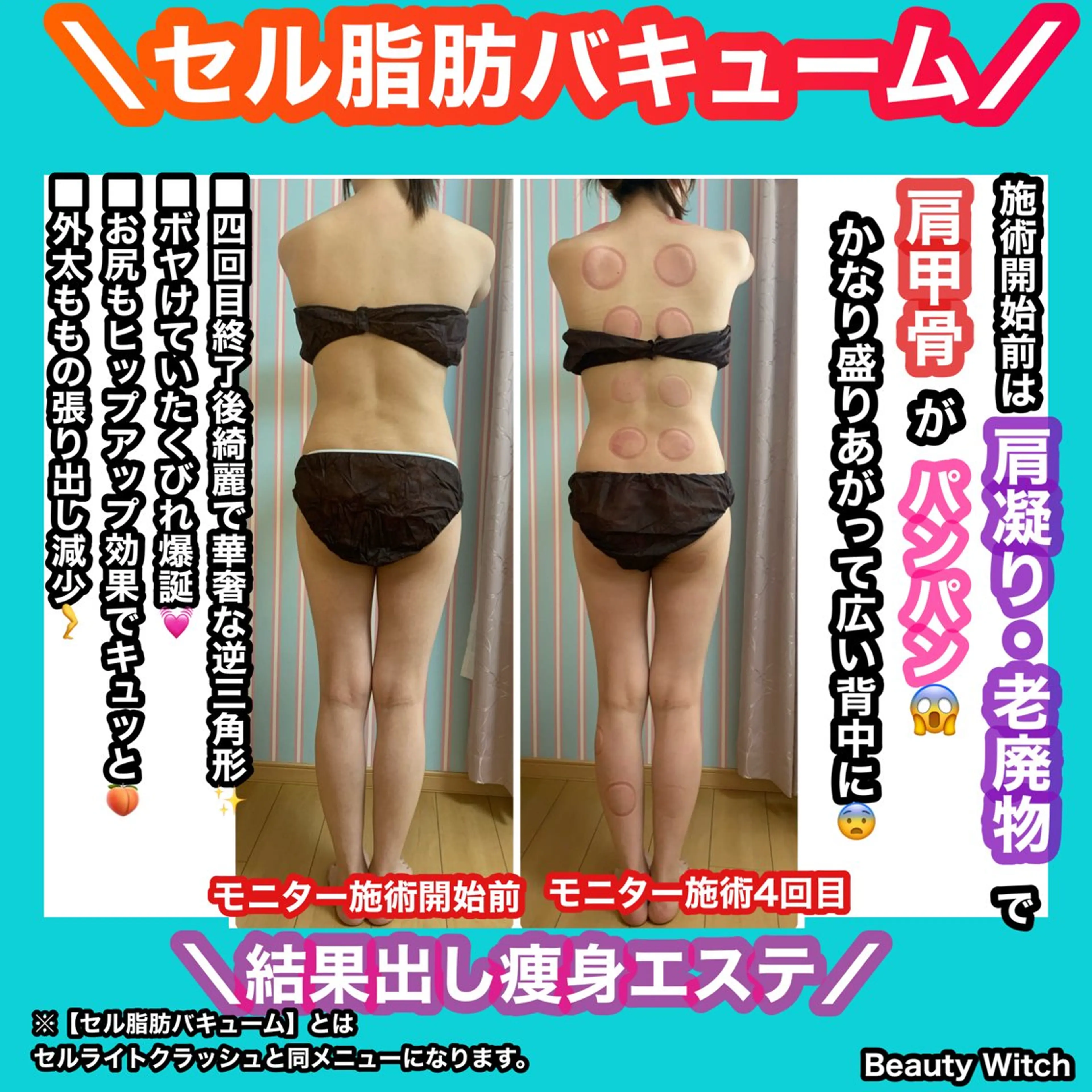 痩身/脱毛/ネイル HARUKAのエステ・リラクイメージ