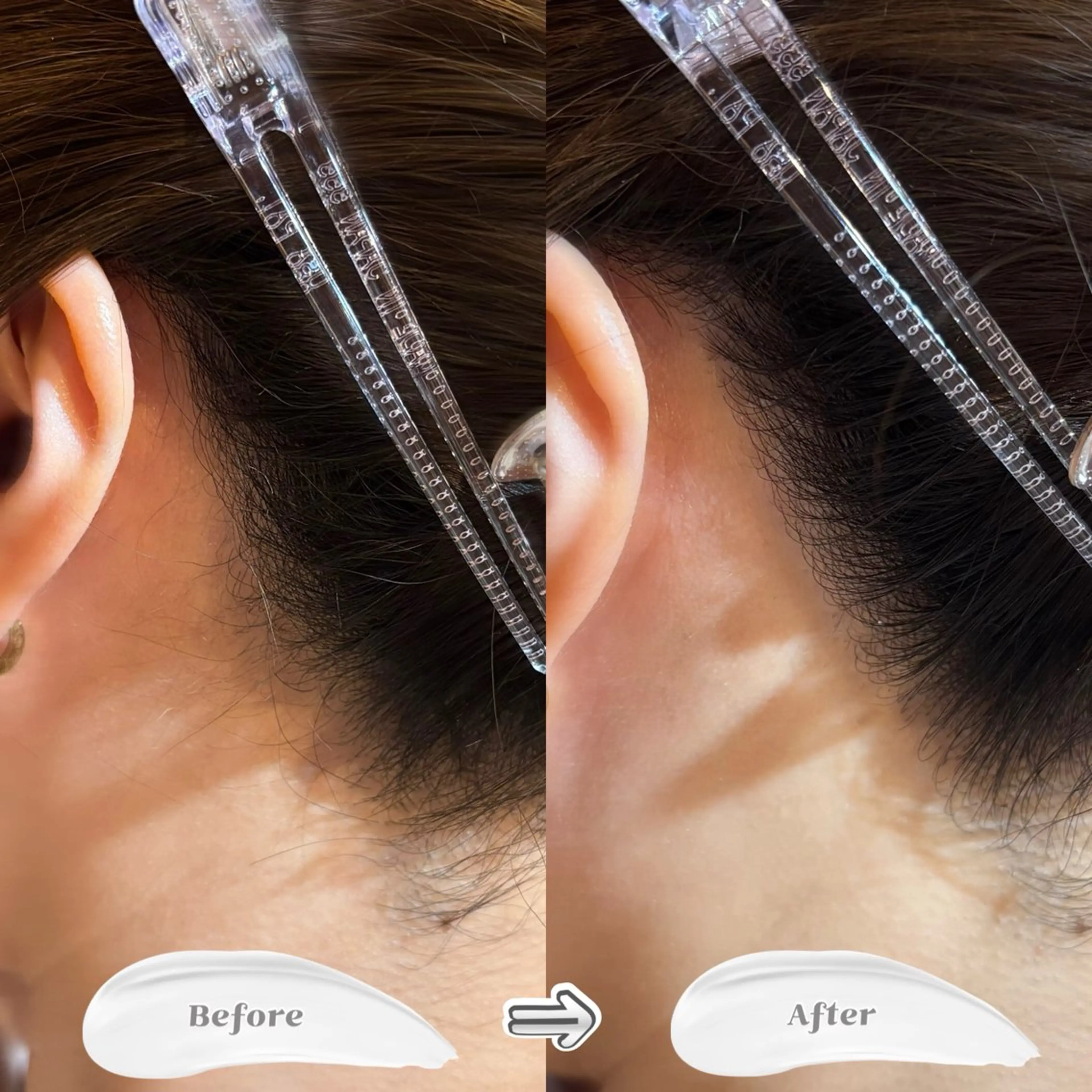 脱毛 あかいけ .のエステ・リラクイメージ