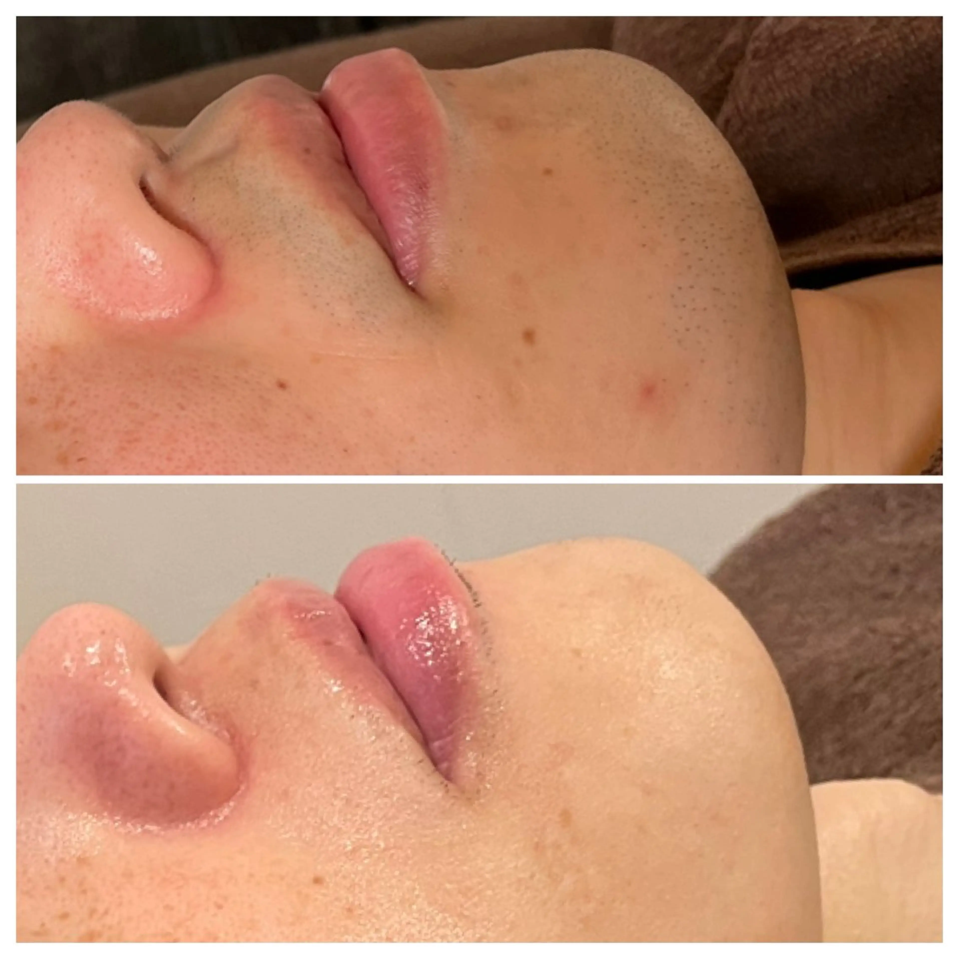 脱毛 浜野 恵美のエステ・リラクイメージ