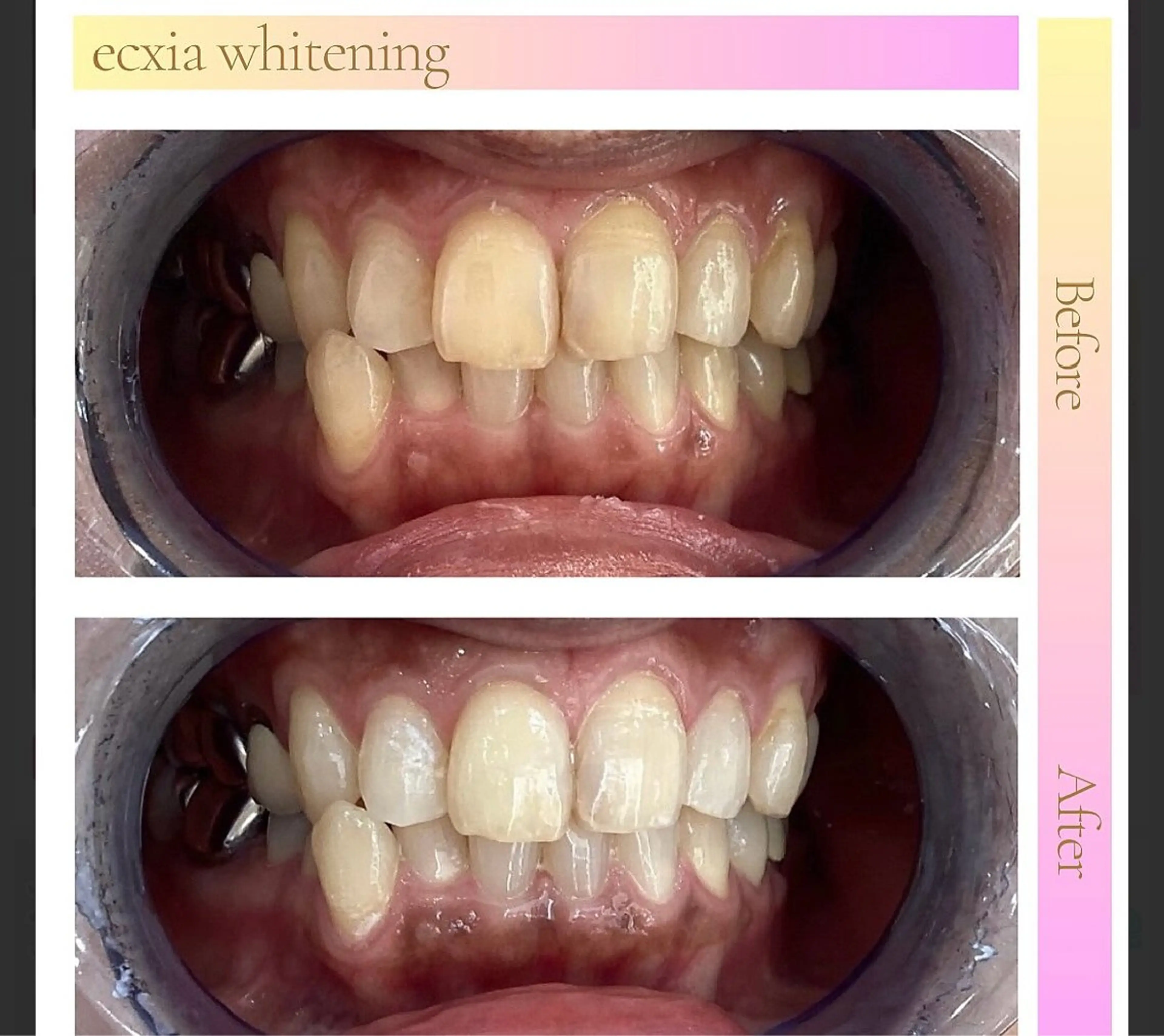 エクシアホワイト長野店所属・セルフホワイトニング エクシア長野店のその他イメージ