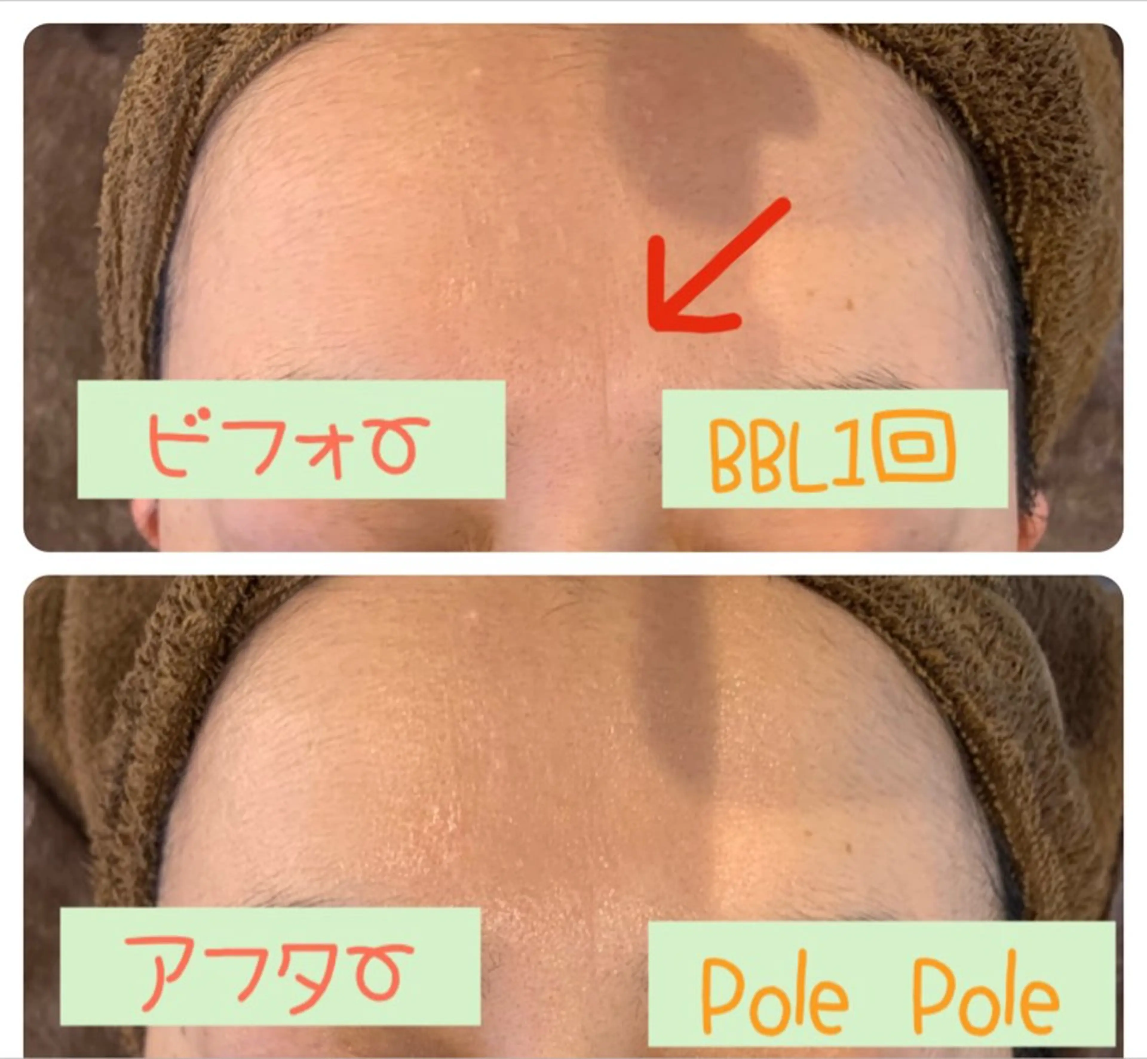 Pole Poleのエステ・リラクイメージ