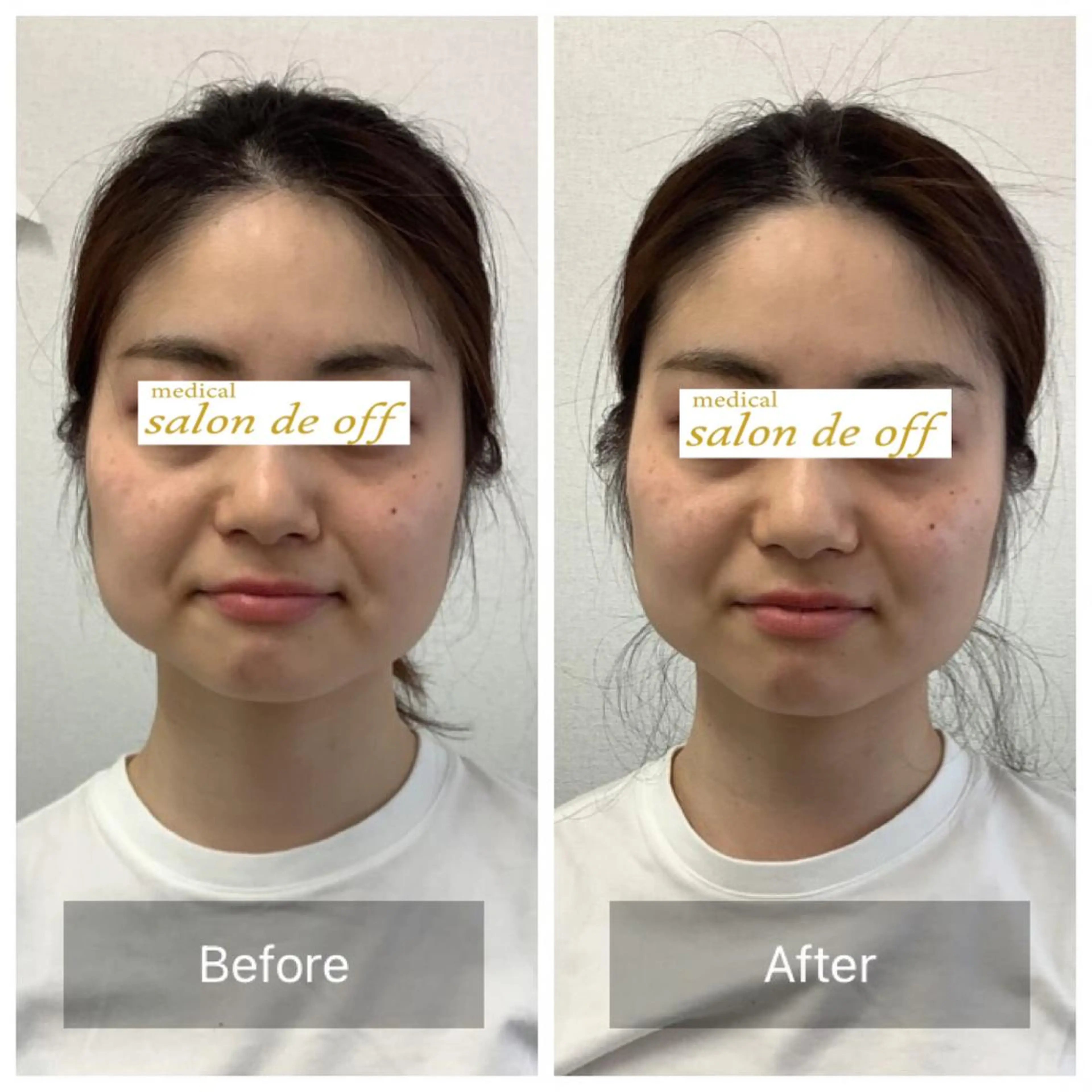 エステ リラク メディカルサロンドオフ所属・ハリサロンドオフ 美容鍼灸×小顔整体のエステ・リラクイメージ