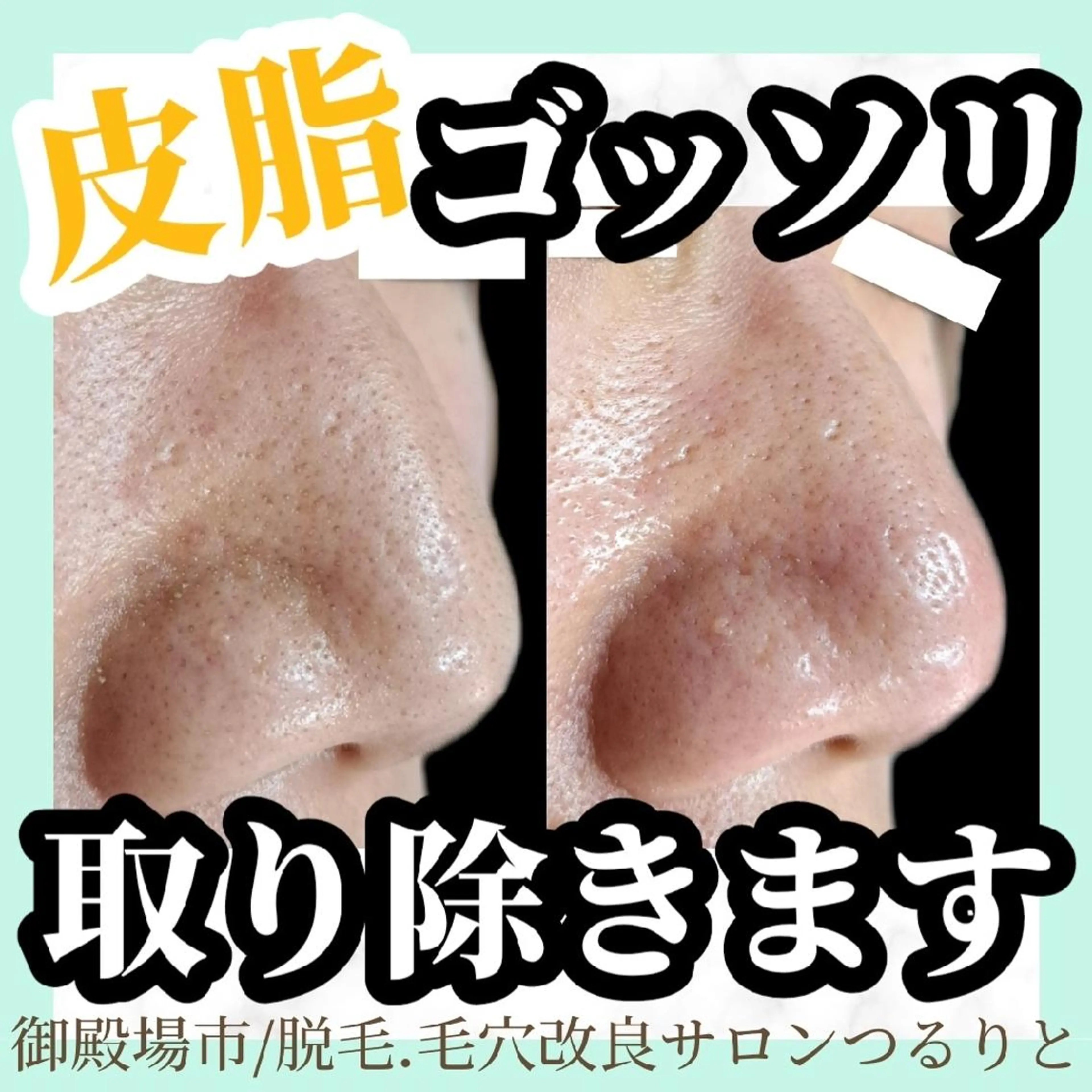 美肌脱毛サロン つるりと御殿場店所属・美肌脱毛サロン つるりとのその他イメージ