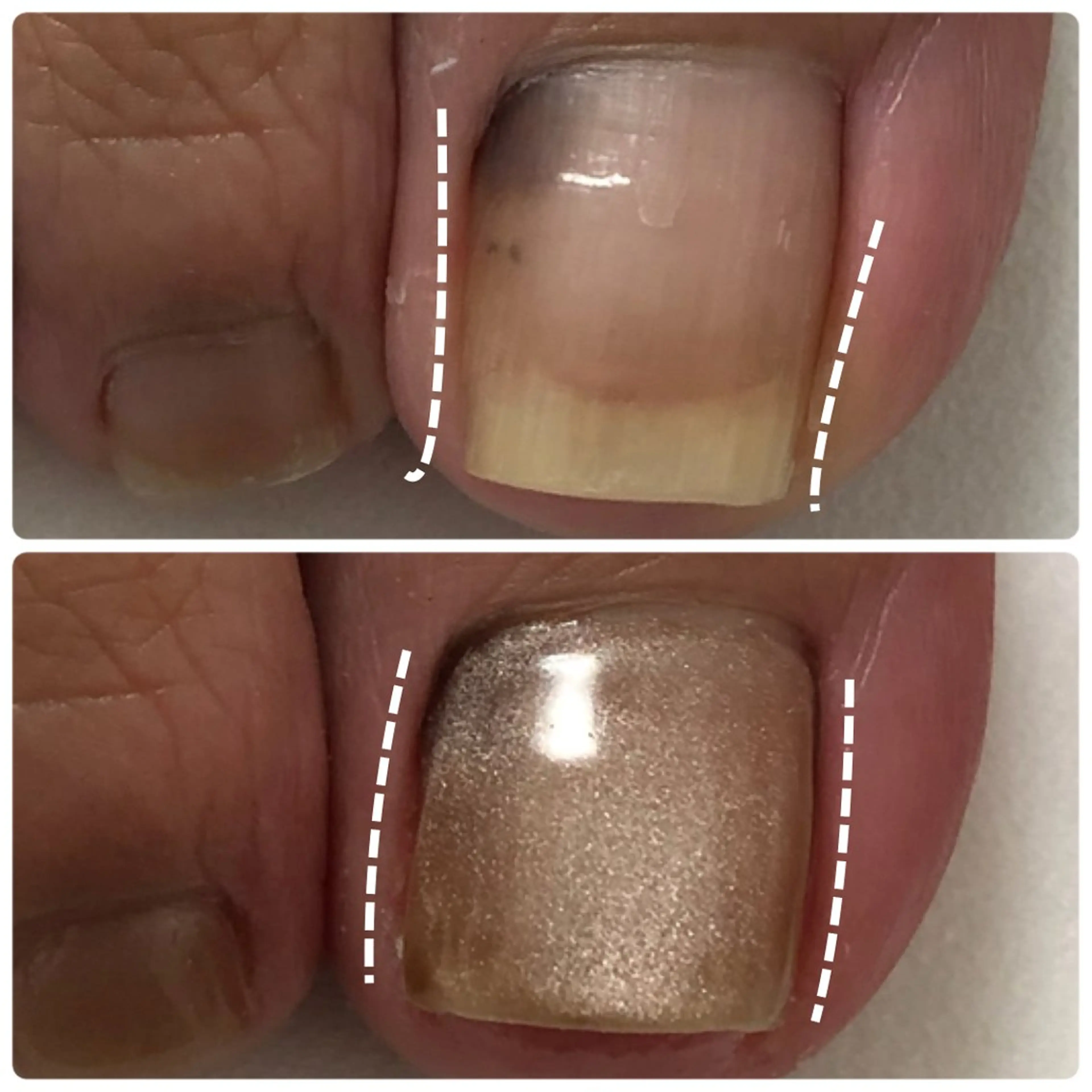 ネイル 自爪育成ネイルケア Lena  nailのネイルデザイン