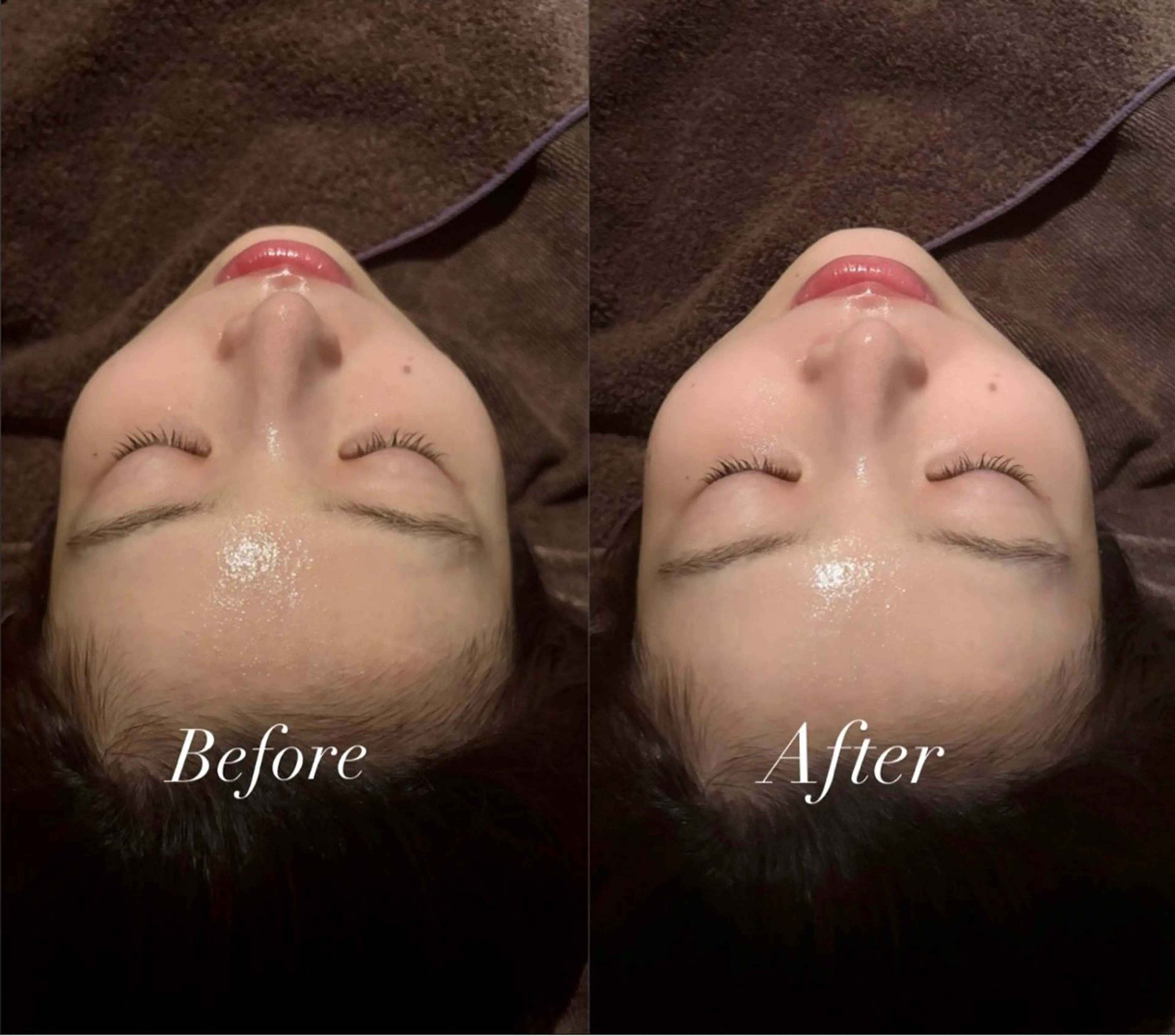 エステ 🌼美肌専門 肌質改善🌼のエステ・リラクイメージ