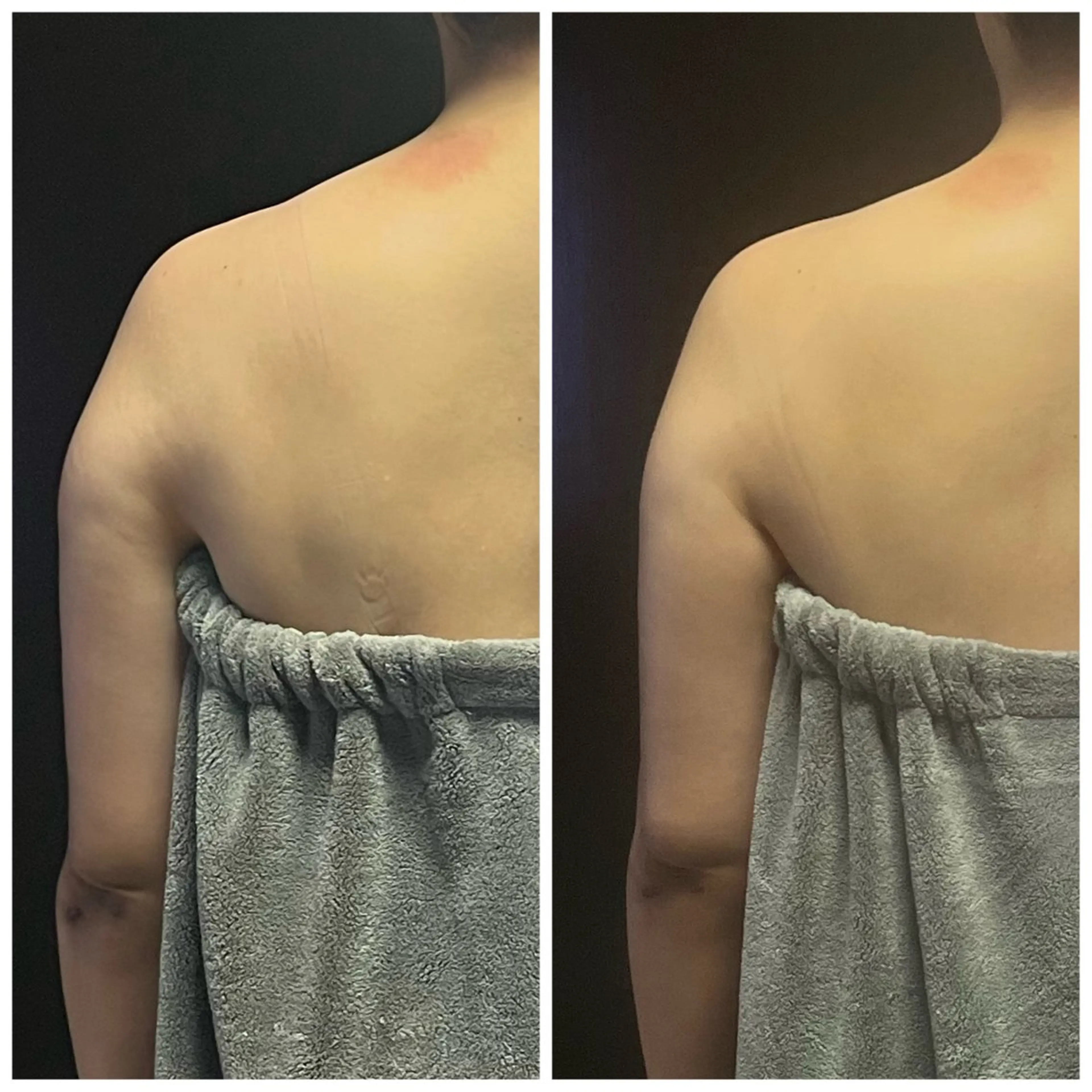 Ｂ&H所属・頭痛•肩こり専門/ 眉サロンB&H心斎橋のエステ・リラクイメージ