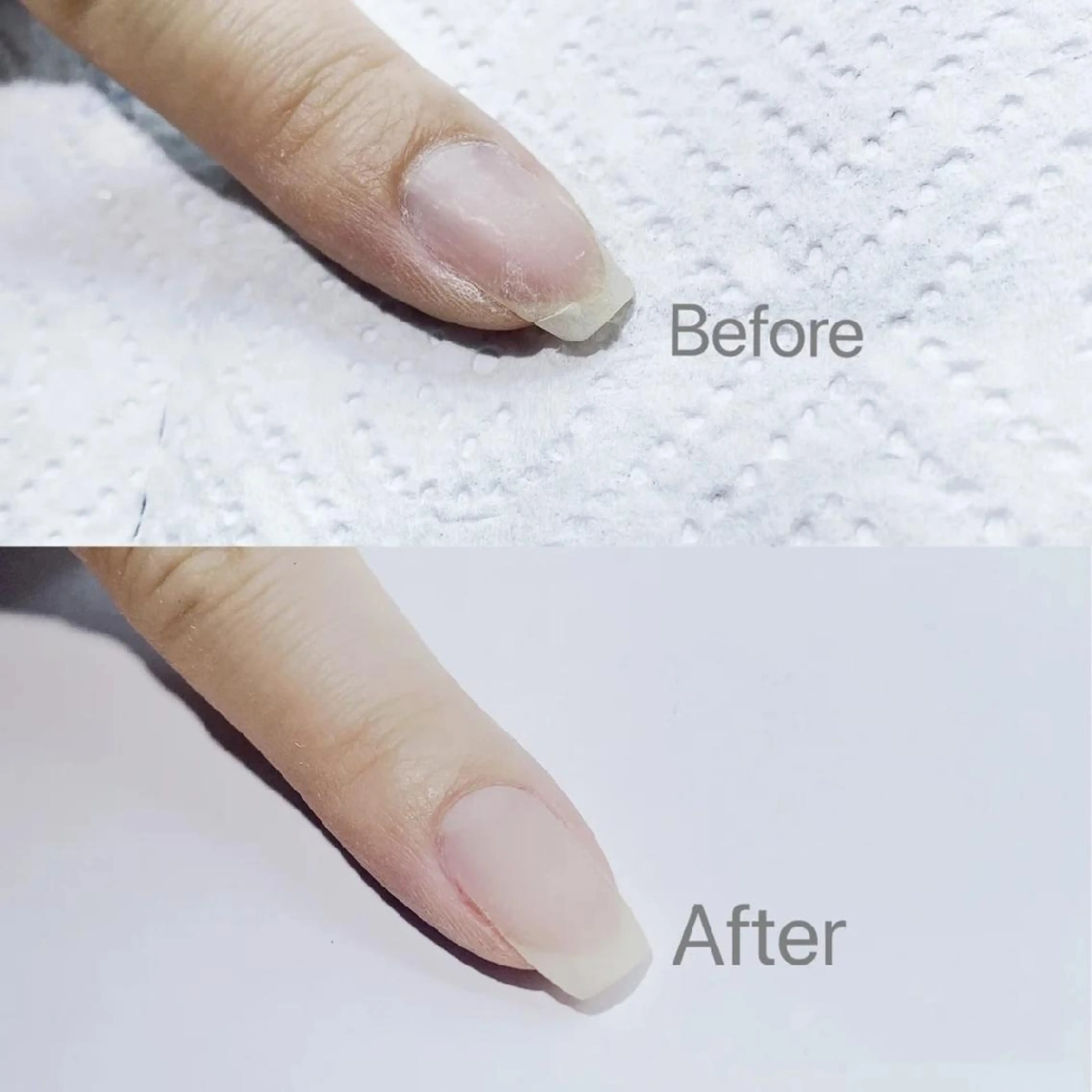 ミディアム ネイル ネイリストゆか💅 長さだし、深爪矯正のネイルデザイン