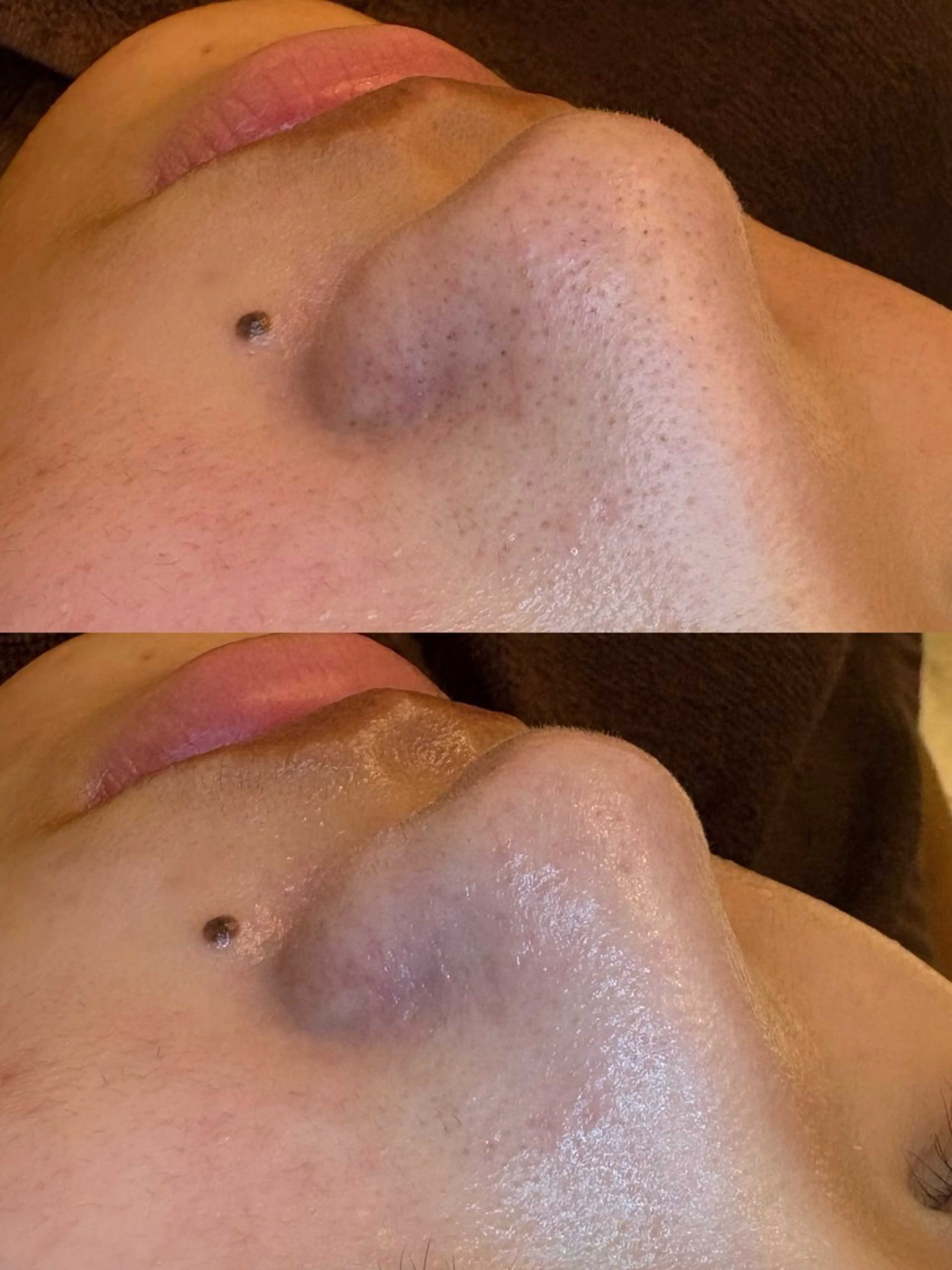 エステ EARTH coiffure beaute 新潟紫竹山店所属・🤍アベシュリ /フェイシャル🤍のエステ・リラクイメージ