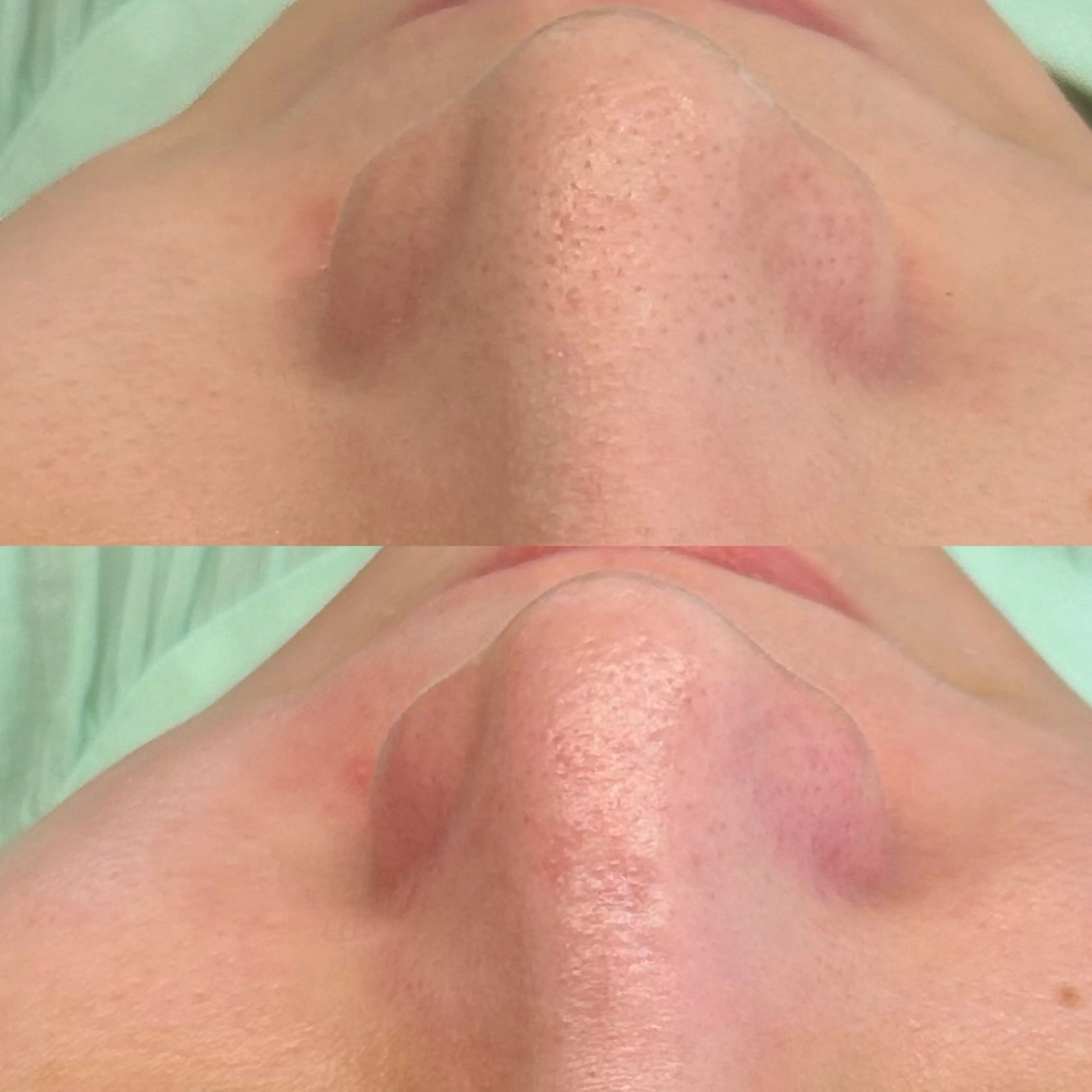 エステ 韓国🇰🇷価格 サロン_Nbibiのエステ・リラクイメージ