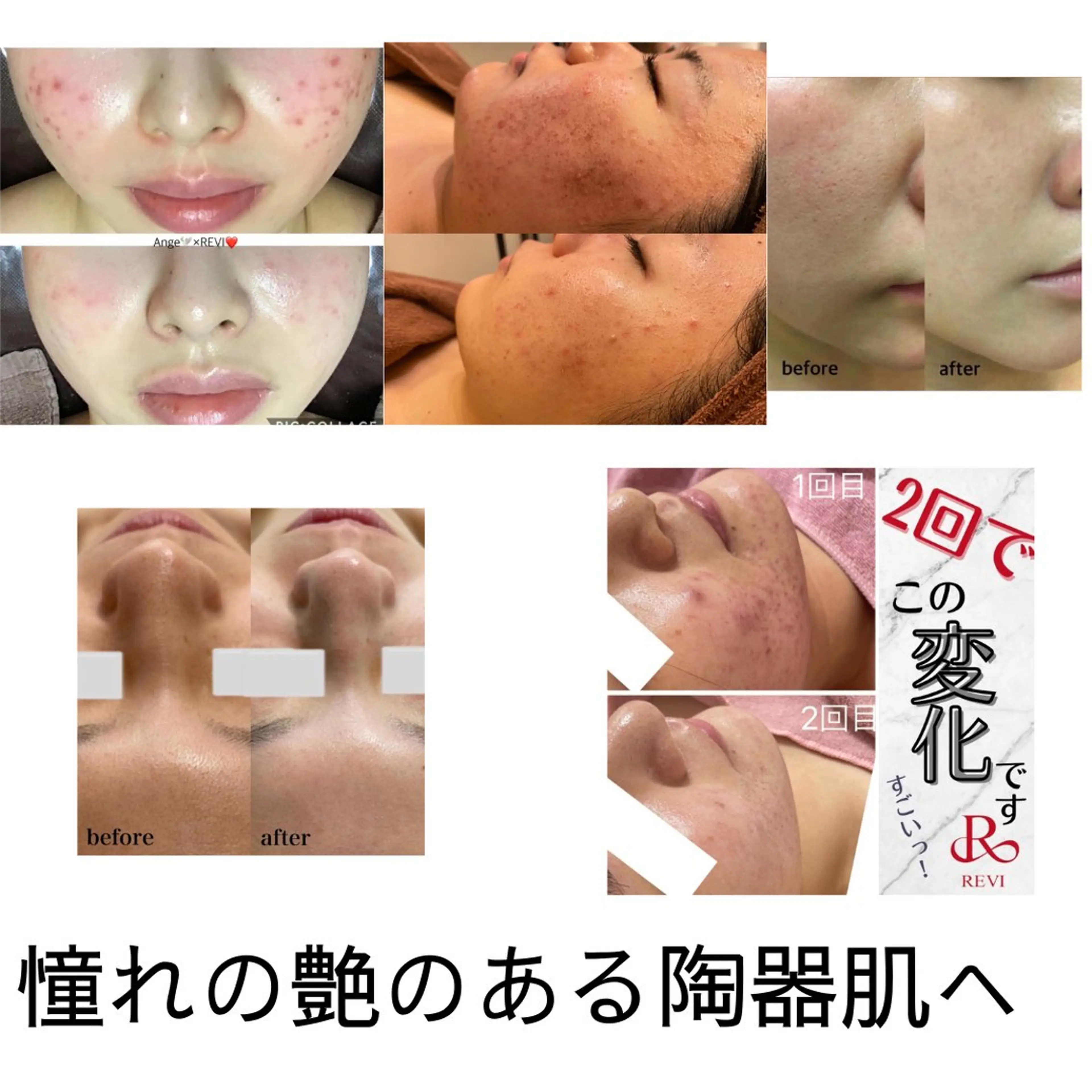 エステ Ange -viva la vida-所属・Ange vivalavidaのエステ・リラクイメージ