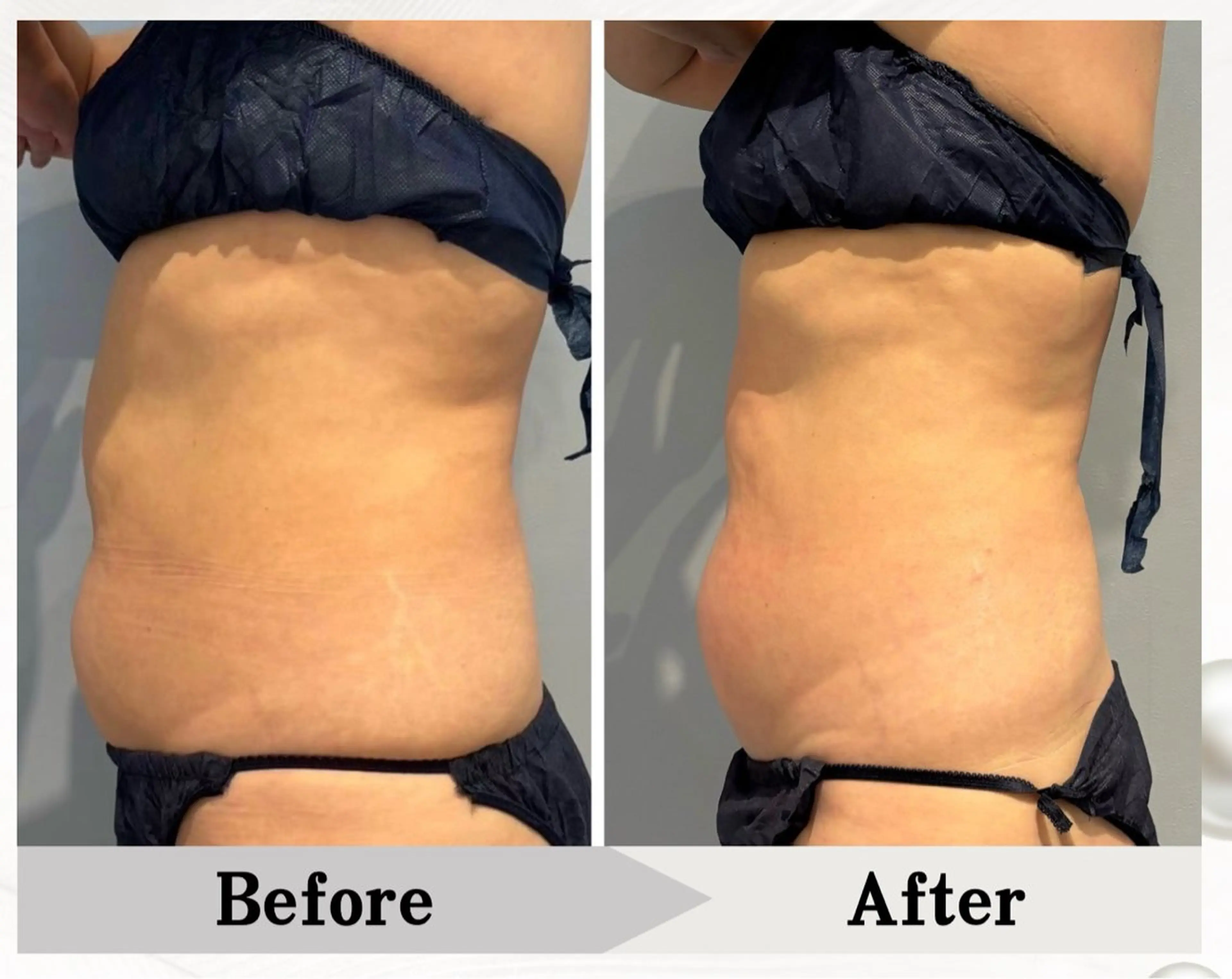 BAUM坂戸 ヘッドスパのエステ・リラクイメージ