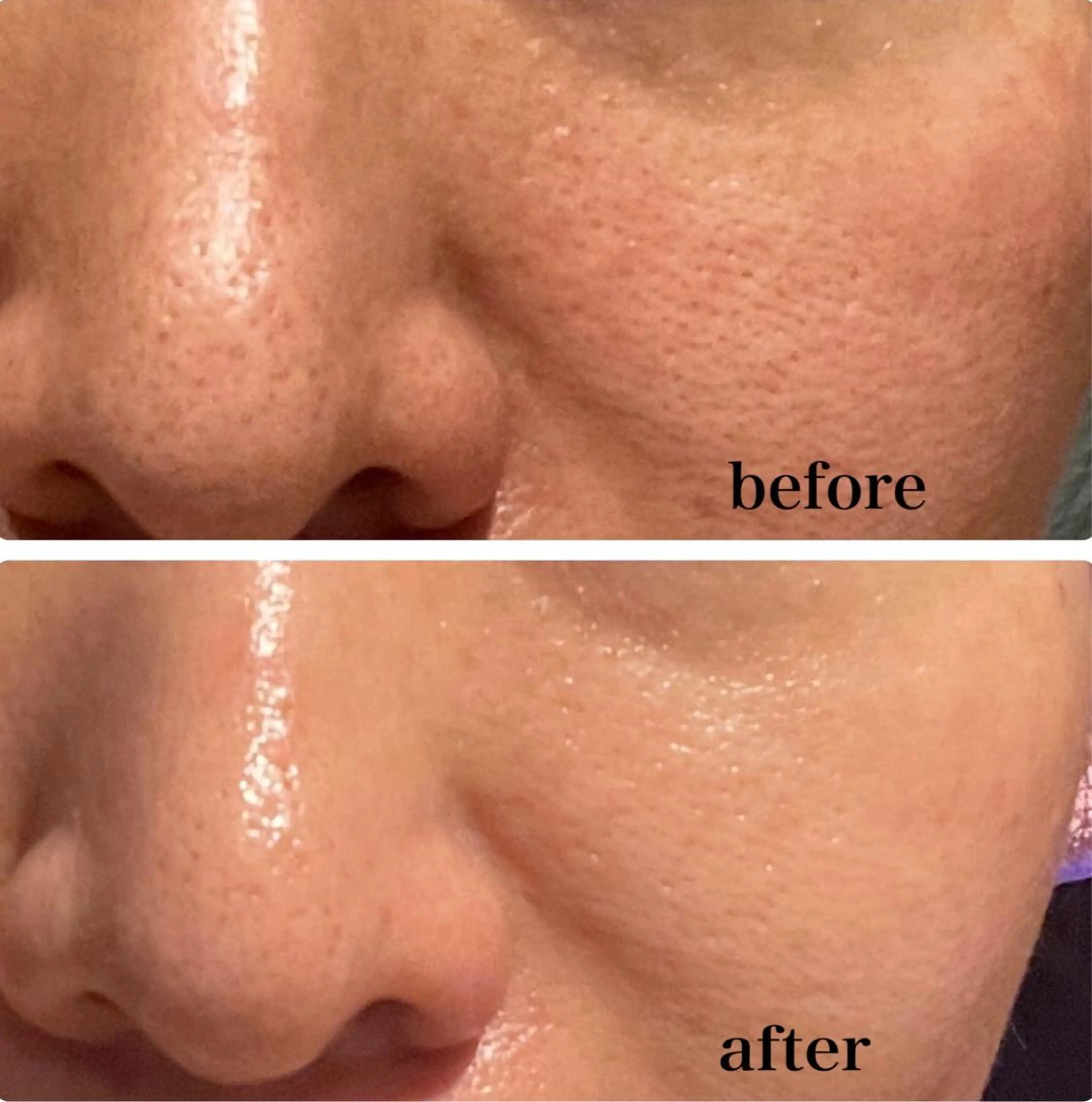 調律エステ /美KISSのその他イメージ