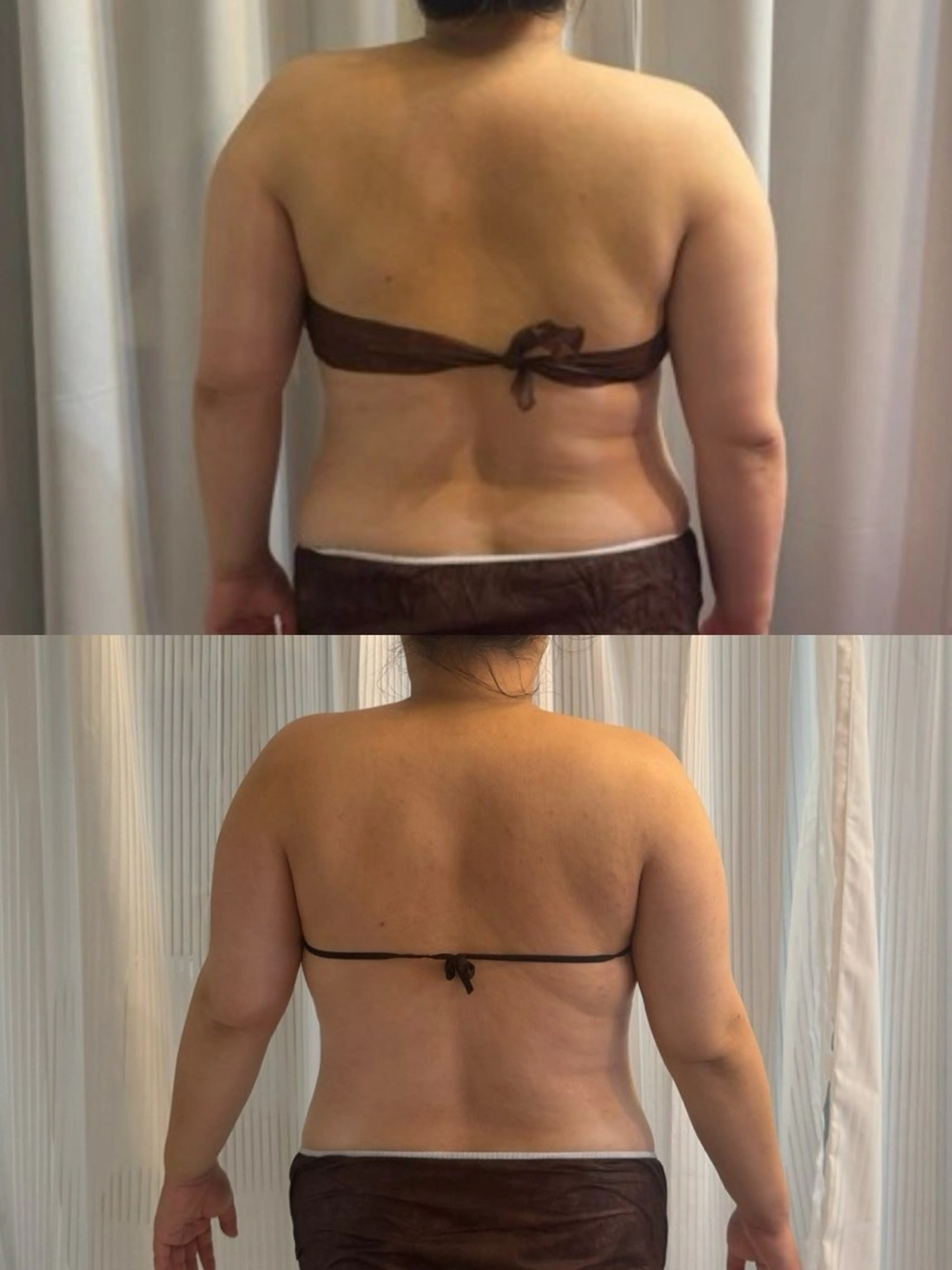 エステ 小顔|痩身salon miélu ミエルのエステ・リラクイメージ