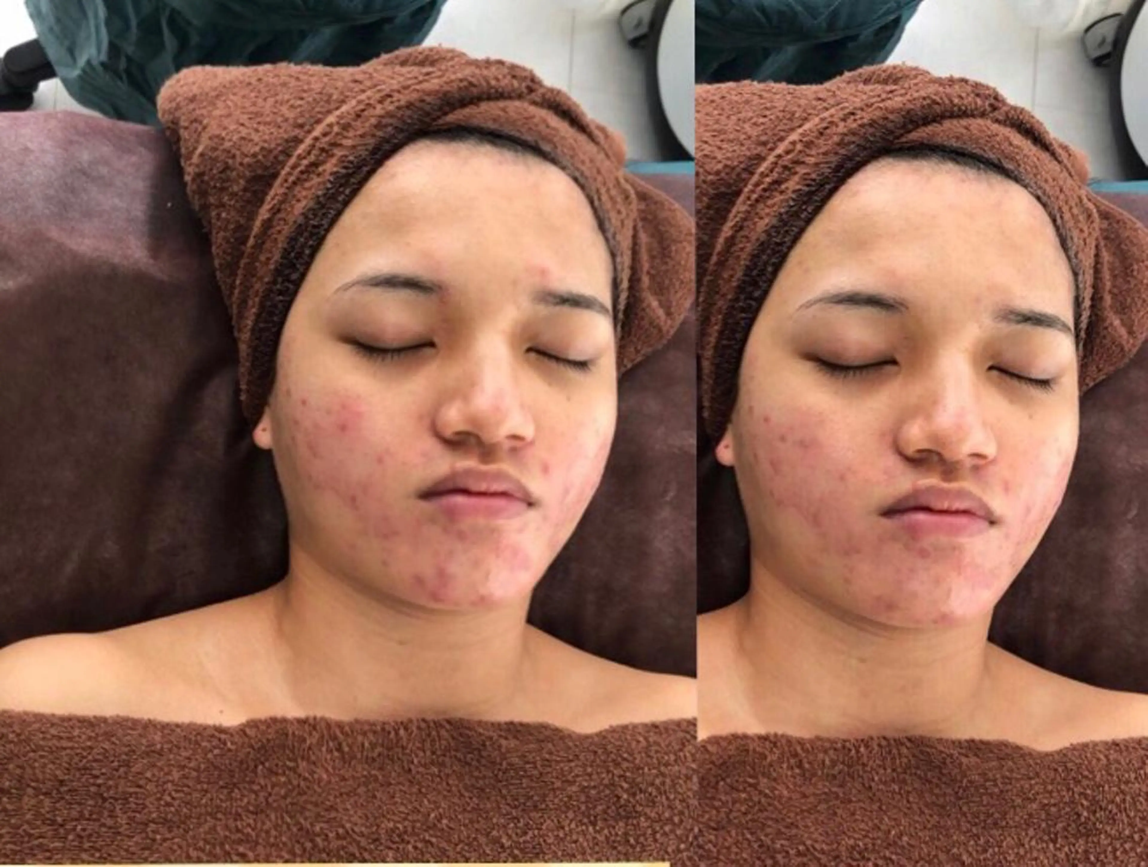 美容医療提携 サロンドシェリーのエステ・リラクイメージ