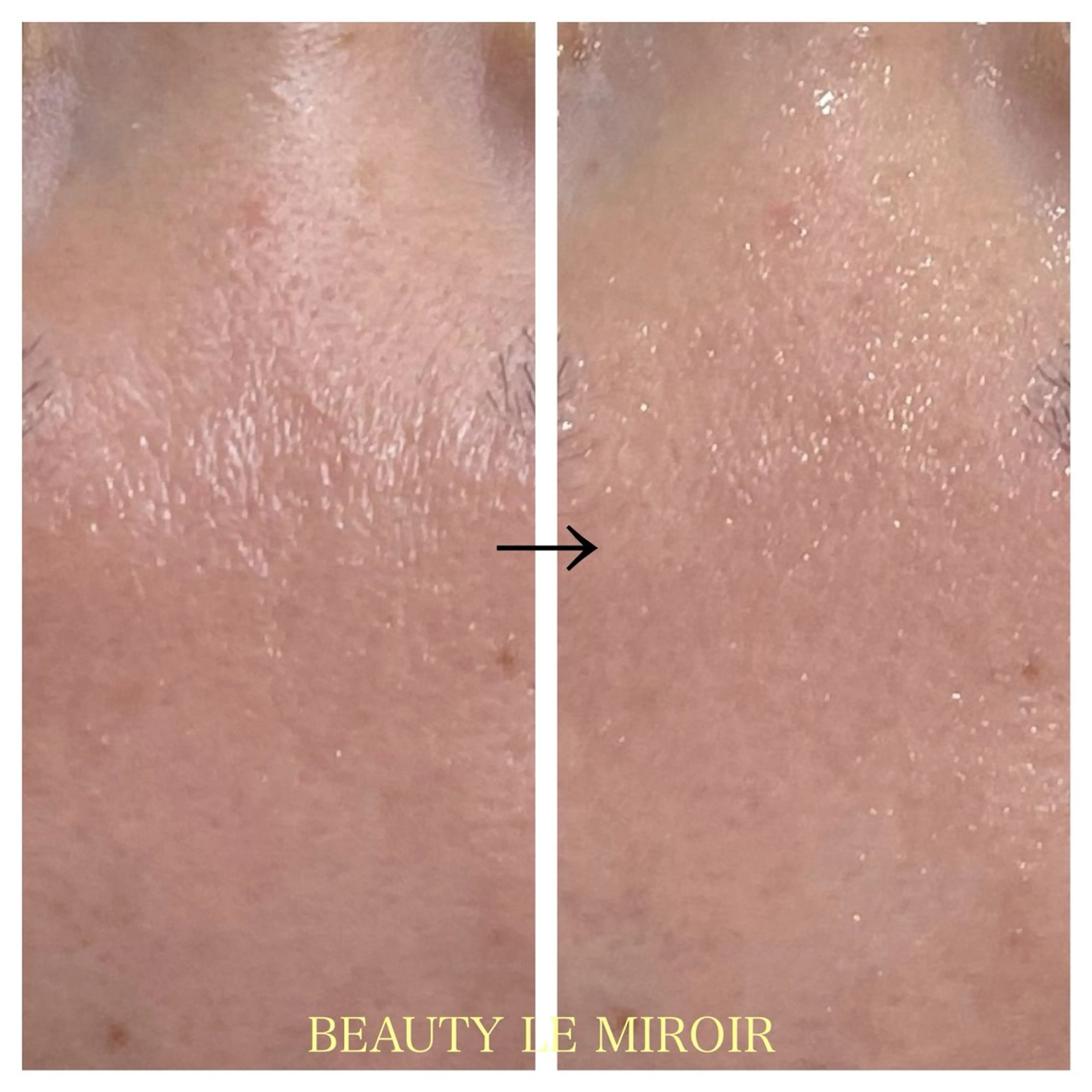 ビューティー ミロワールのエステ・リラクイメージ