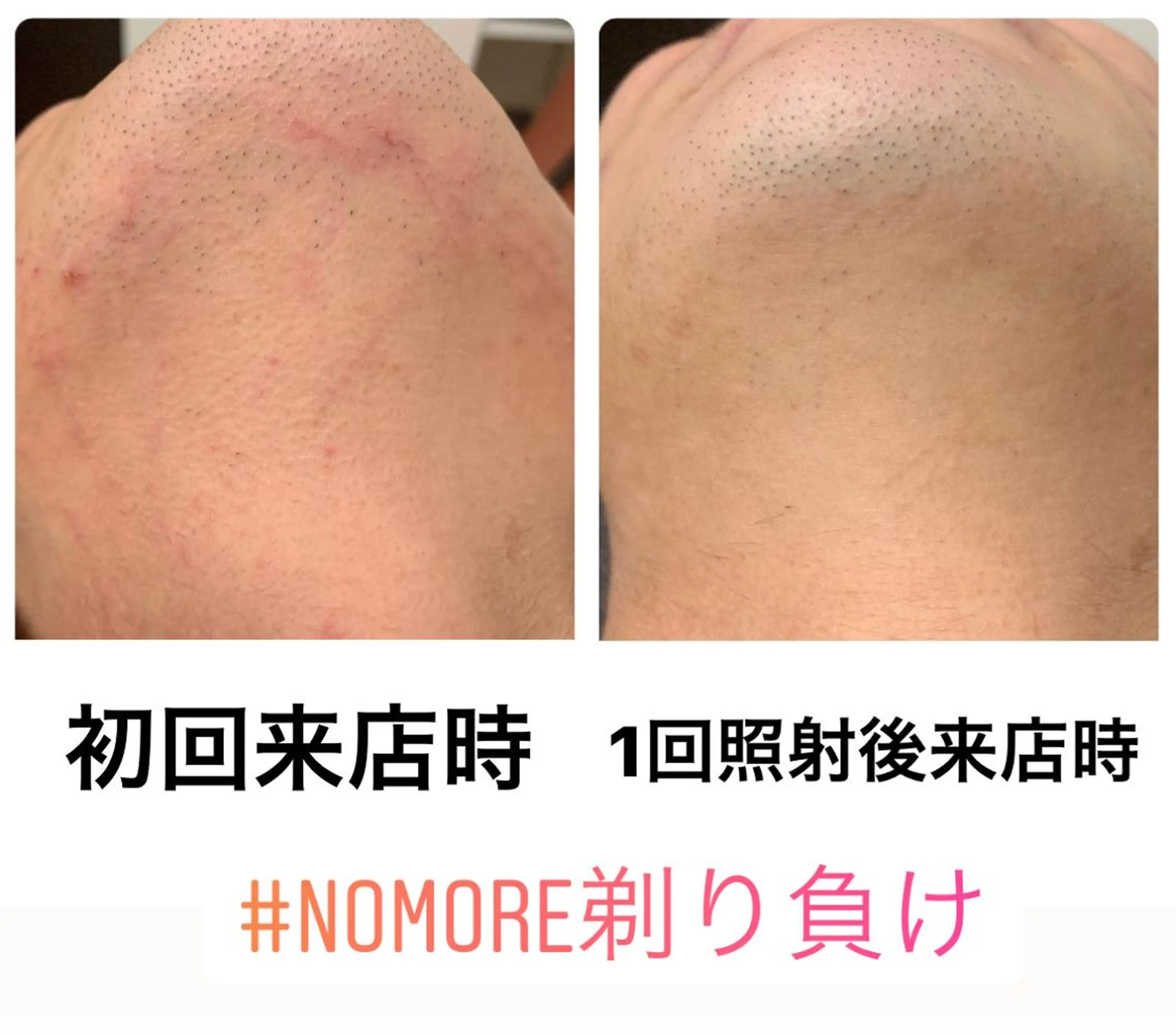 脱毛 メンズ脱毛サロン Le falcoのエステ・リラクイメージ