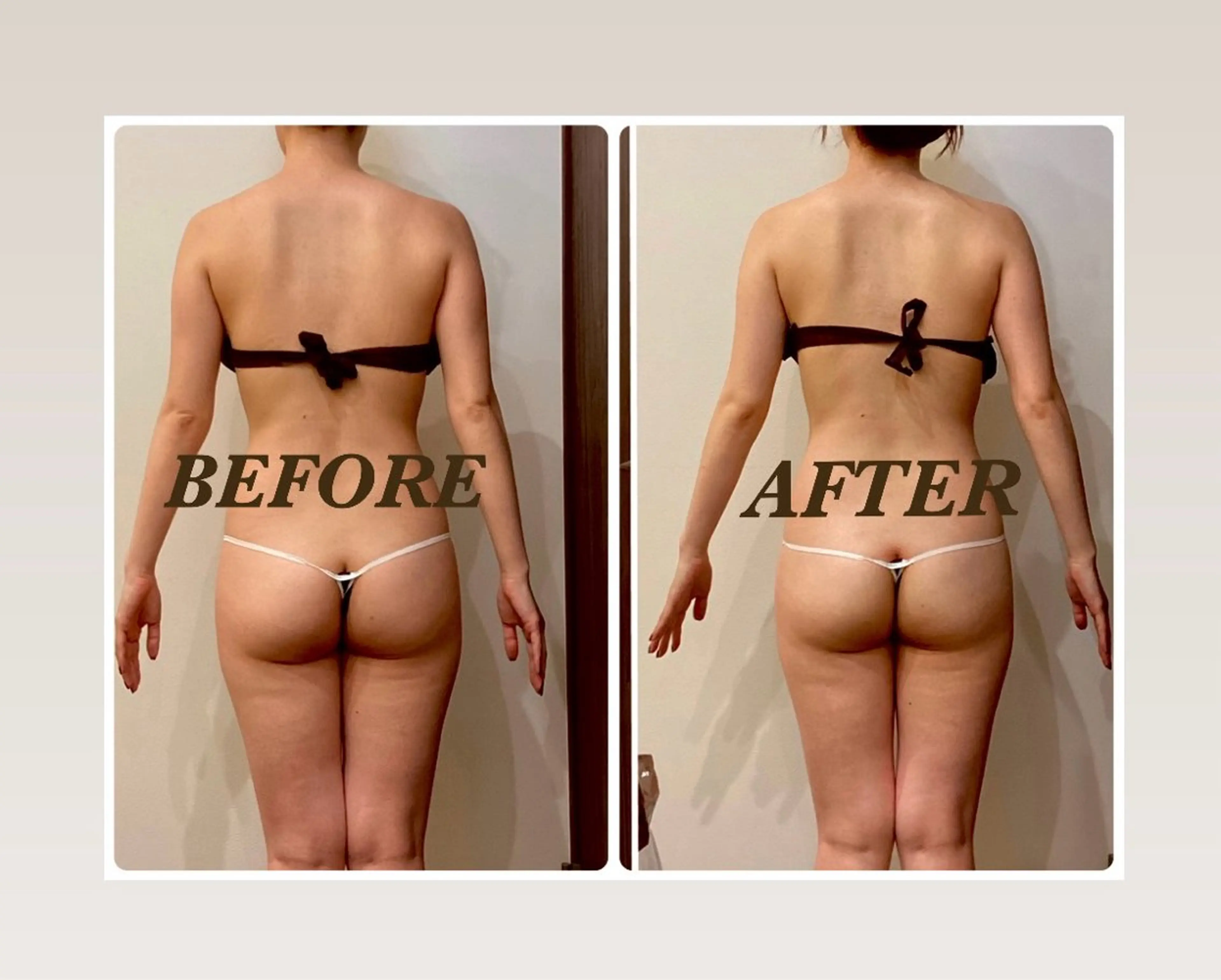 【全身痩せデトックスリンパ×ラジオ波90分¥7,700】冷え太り🧊/ストレス太りに😫🙆‍♀️の写真