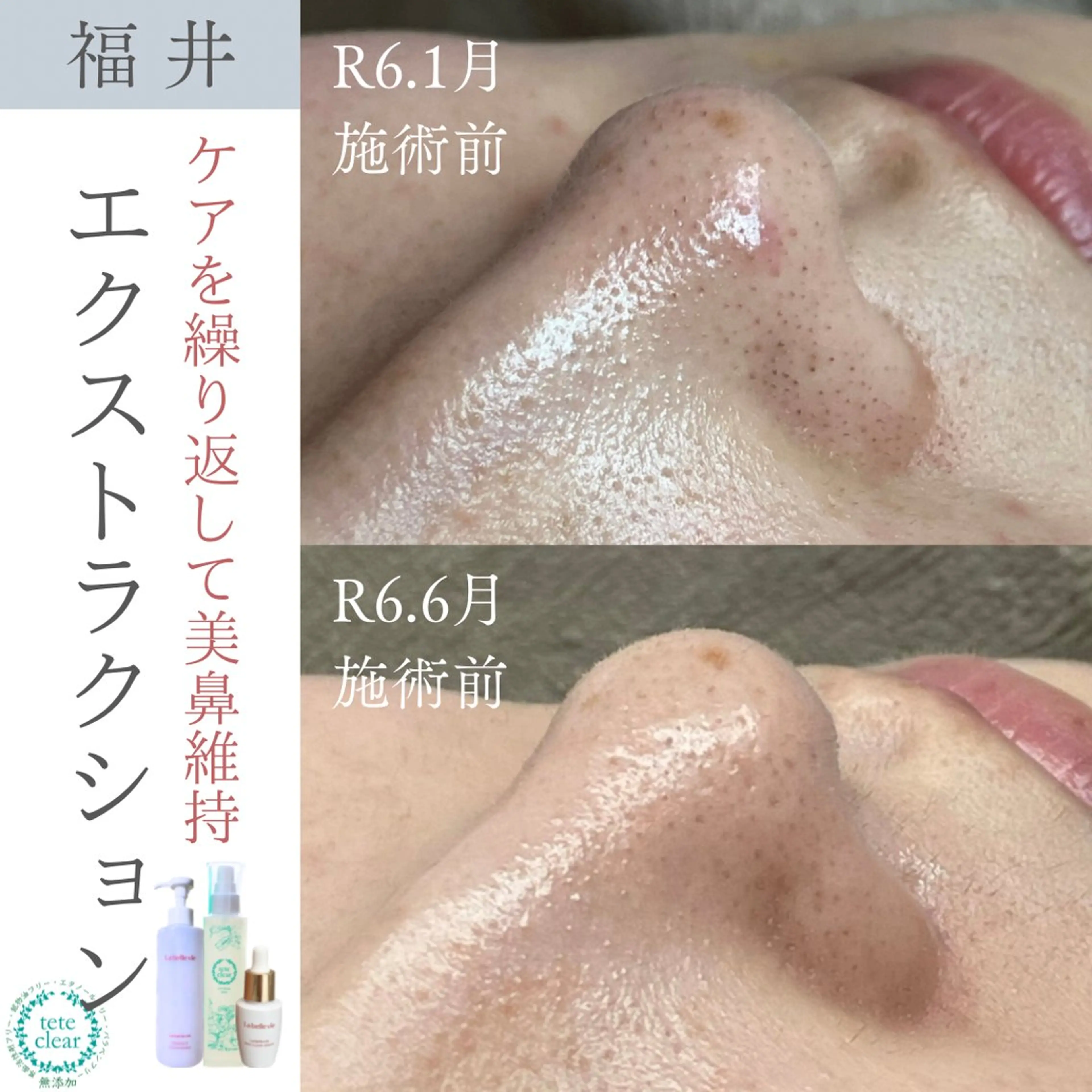 毛穴肌質ケアサロン Yourmeユアミーのエステ・リラクイメージ