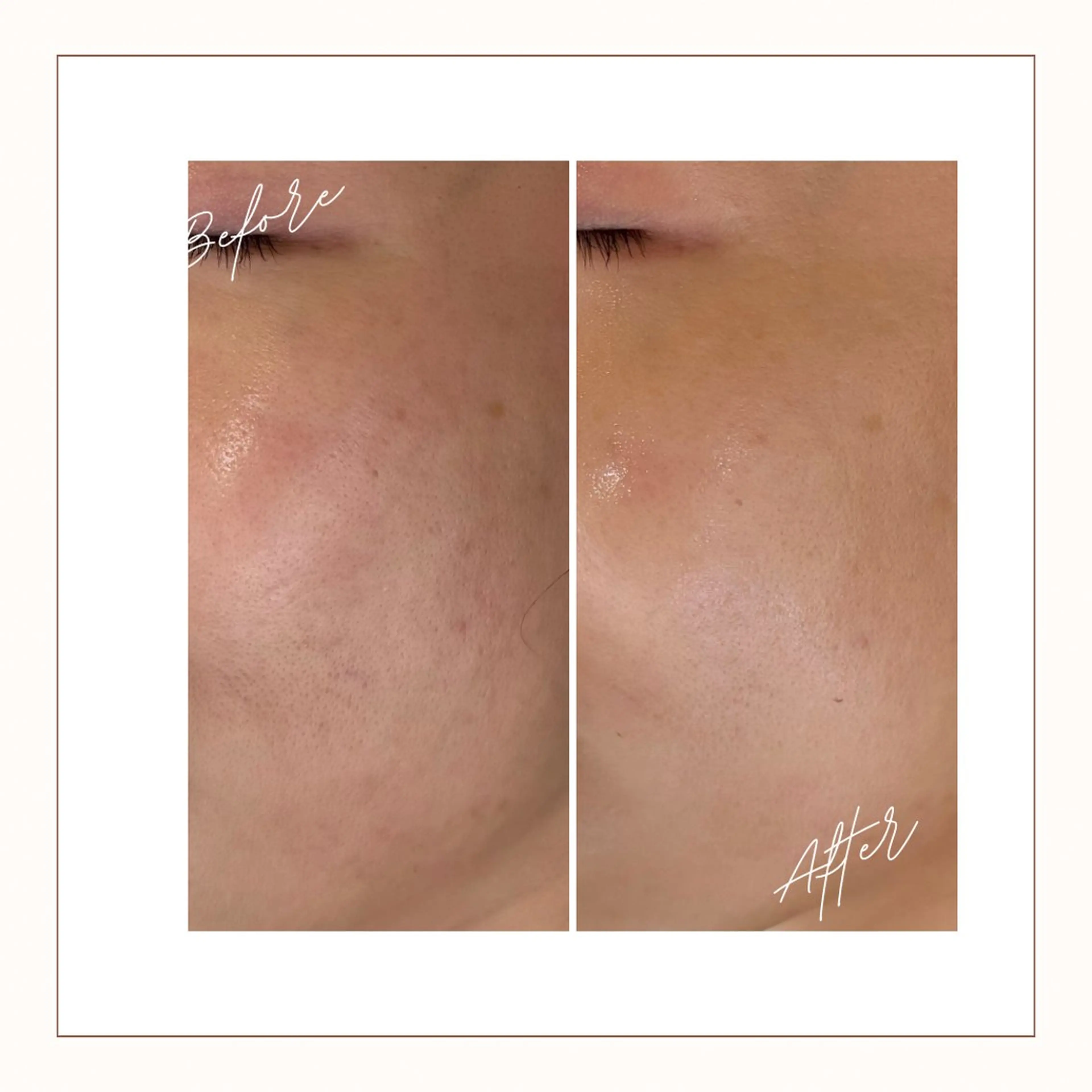 エステ écla【中崎町】 yukikoのエステ・リラクイメージ