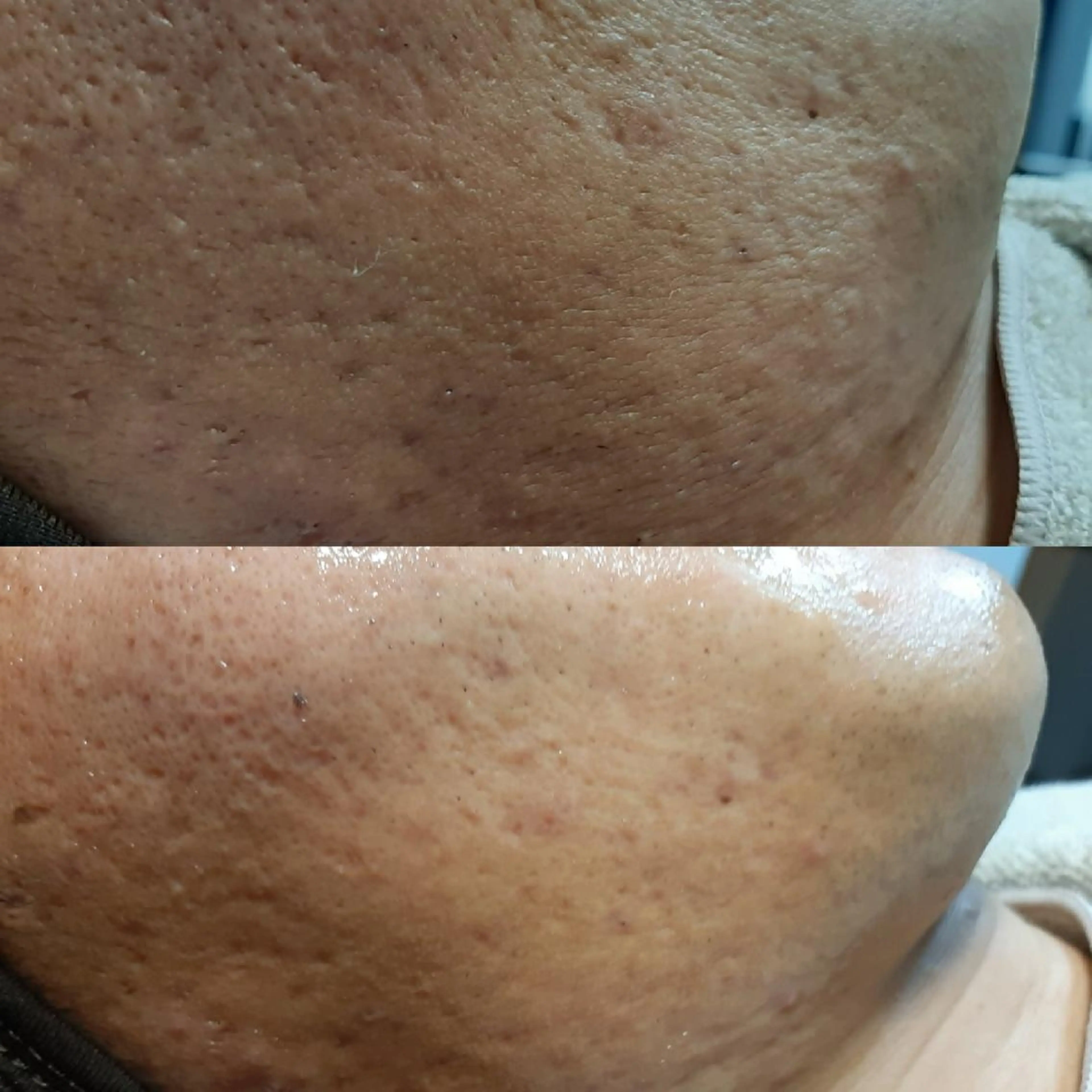 eyelash  e'nのマツエク・マツパデザイン