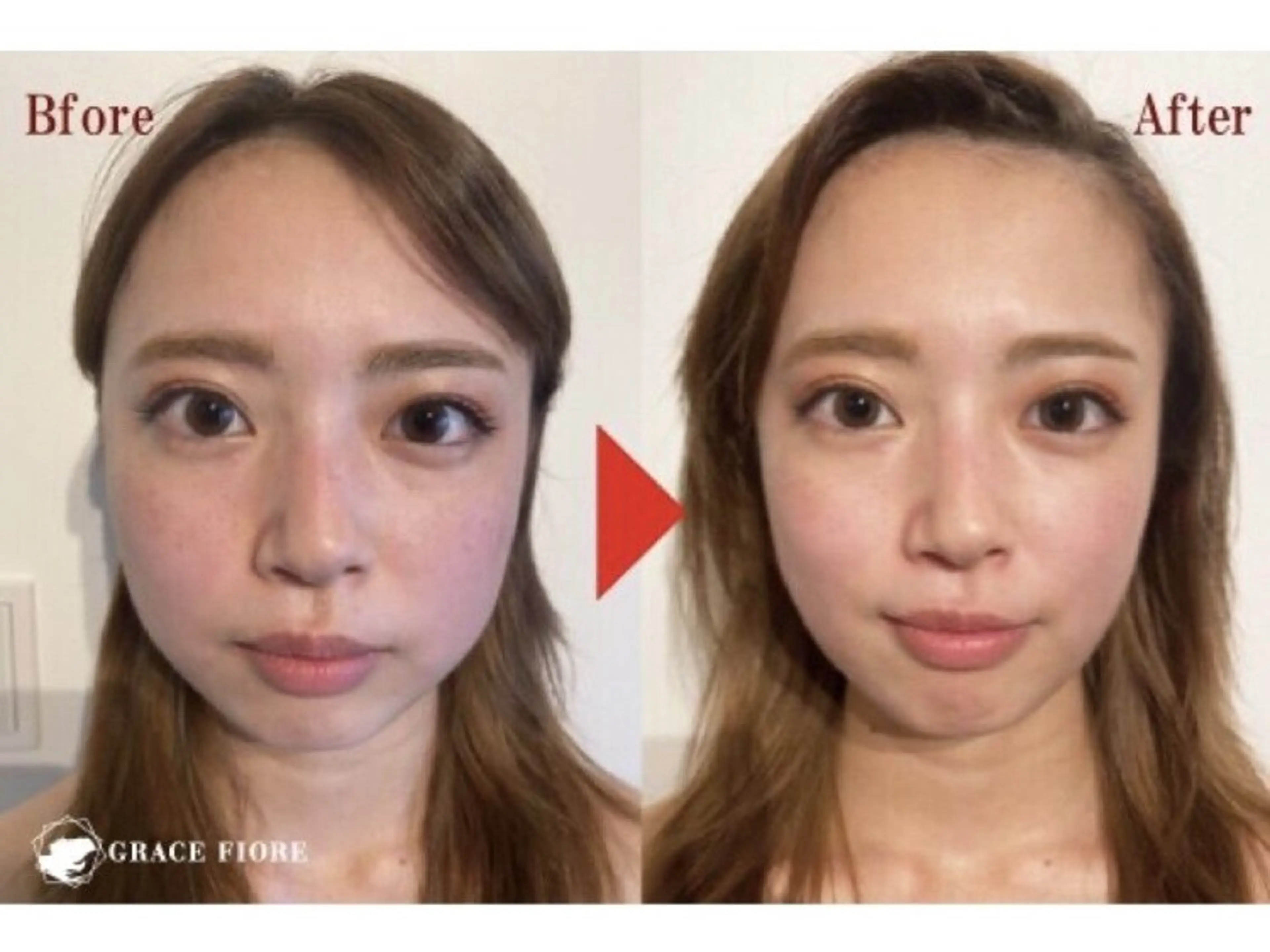 【頭蓋骨小顔矯正】ヘッドスパ→クレンジング・洗顔→整顔マッサージ→リンパドレナージュ（首肩・デコルテ・肩甲骨）の写真