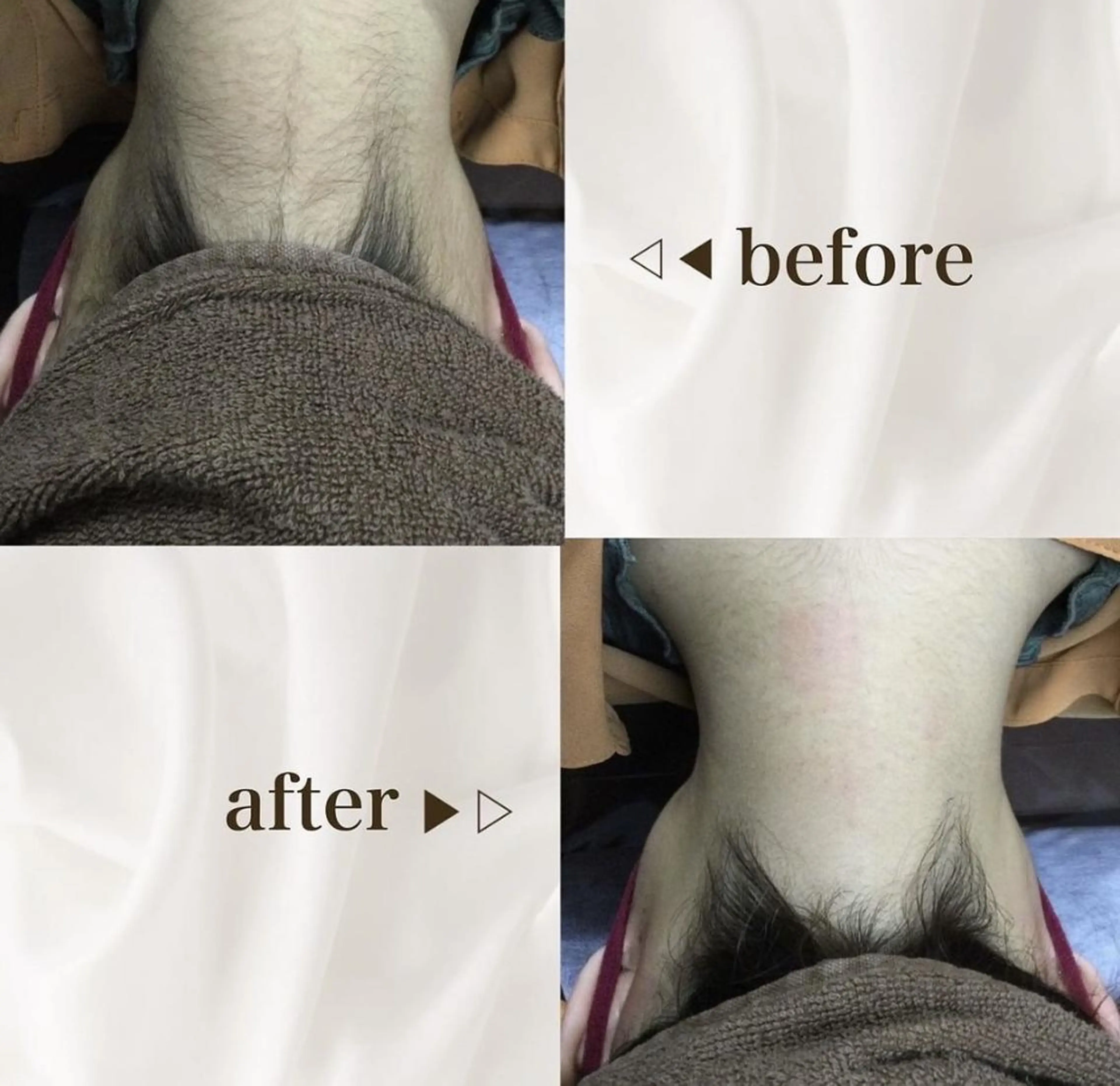 脱毛 リンリン 栄店のエステ・リラクイメージ