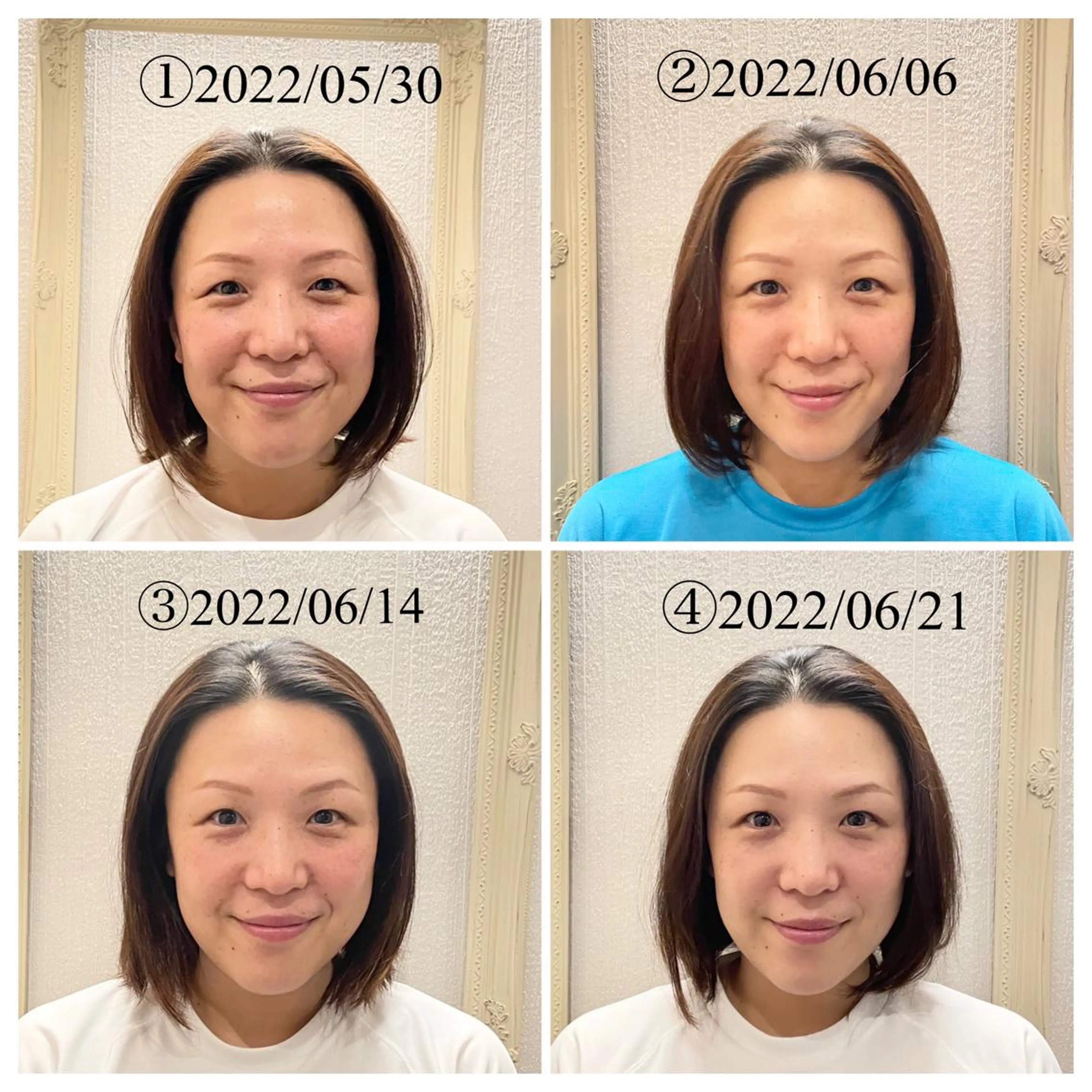 美容鍼　蒼月-aotsuki-所属・美容鍼「蒼月」 -アオツキ-のエステ・リラクイメージ