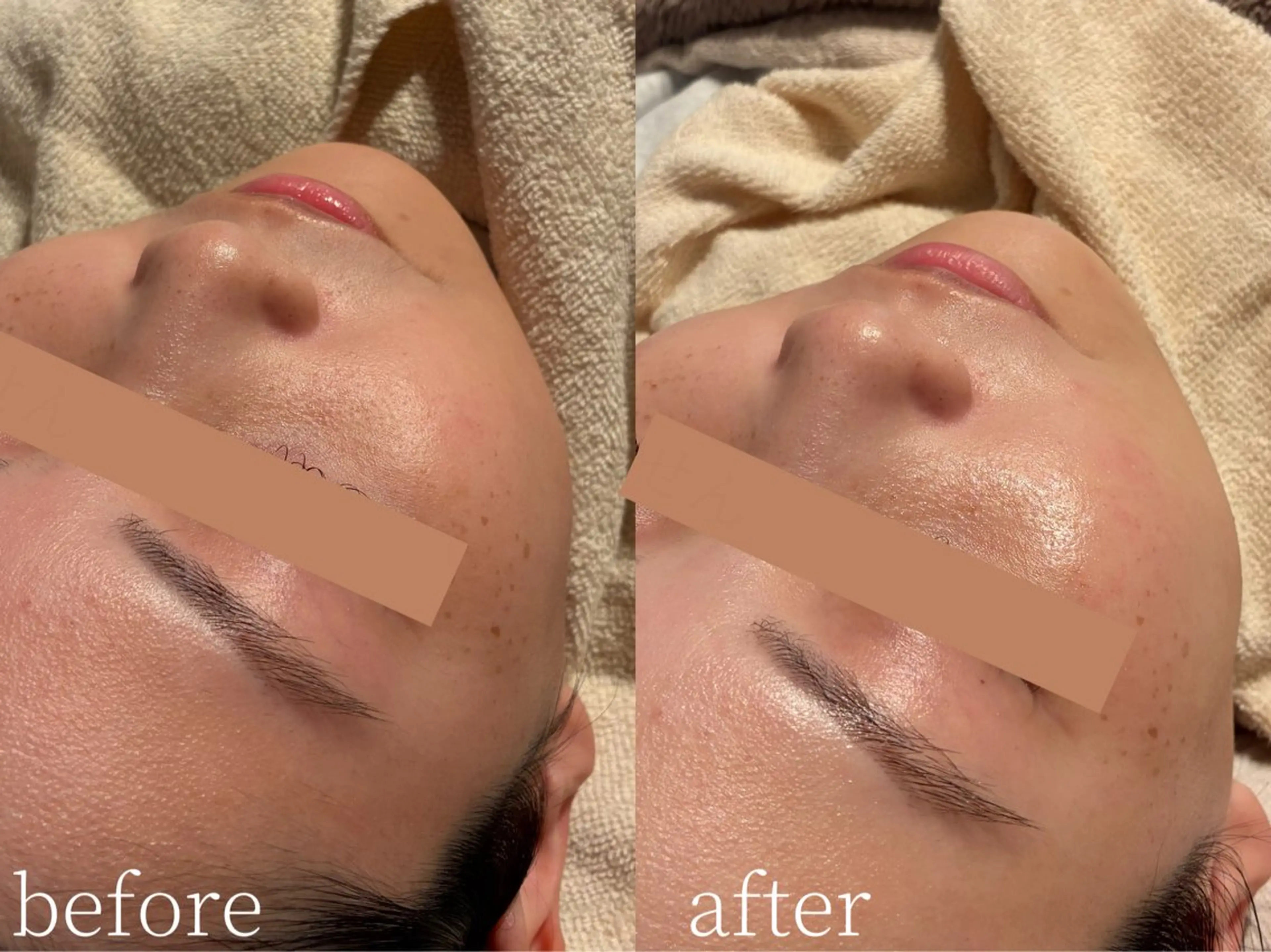 その他 Erika komorebi_のエステ・リラクイメージ