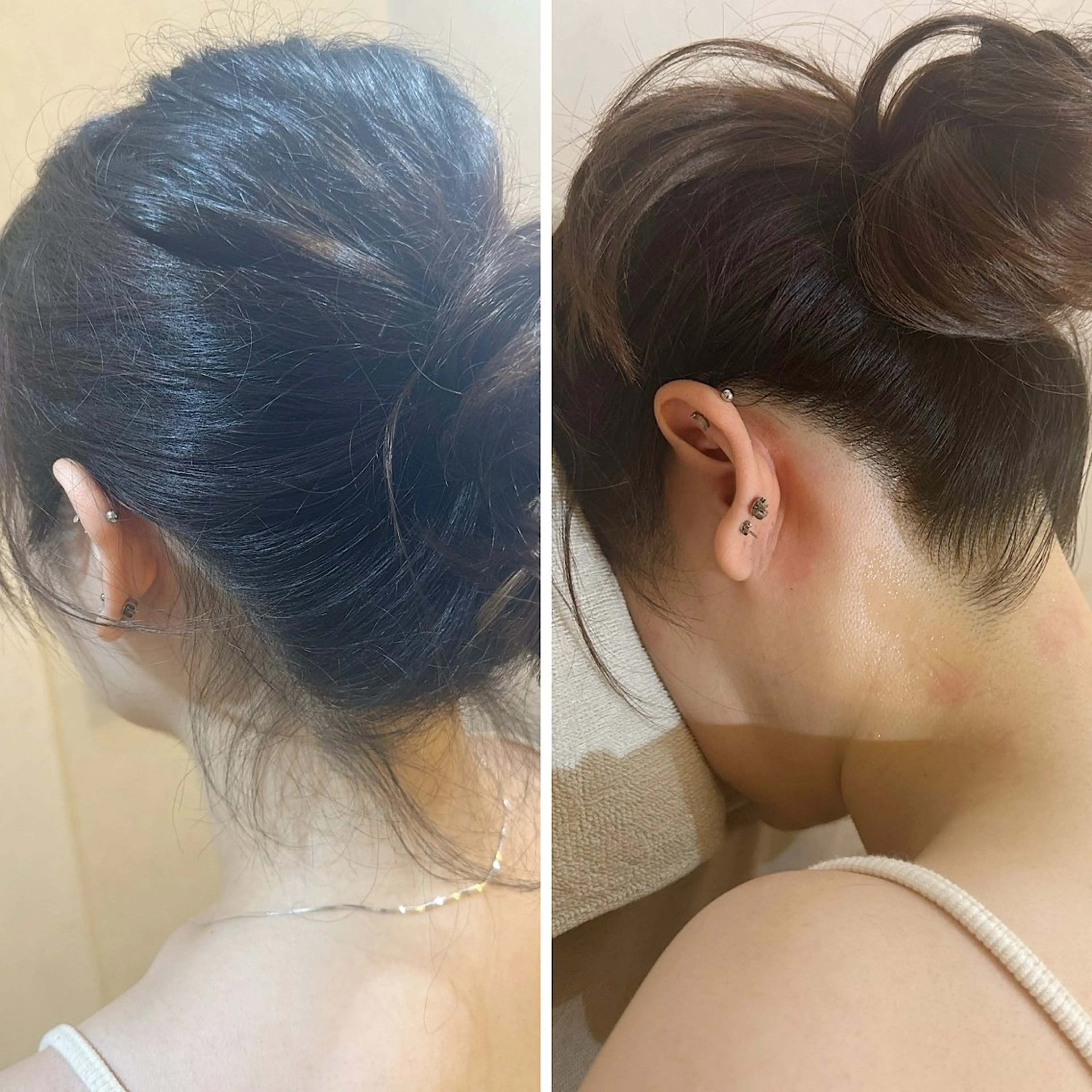 脱毛 うなじ脱毛/美肌脱毛 LABELのエステ・リラクイメージ