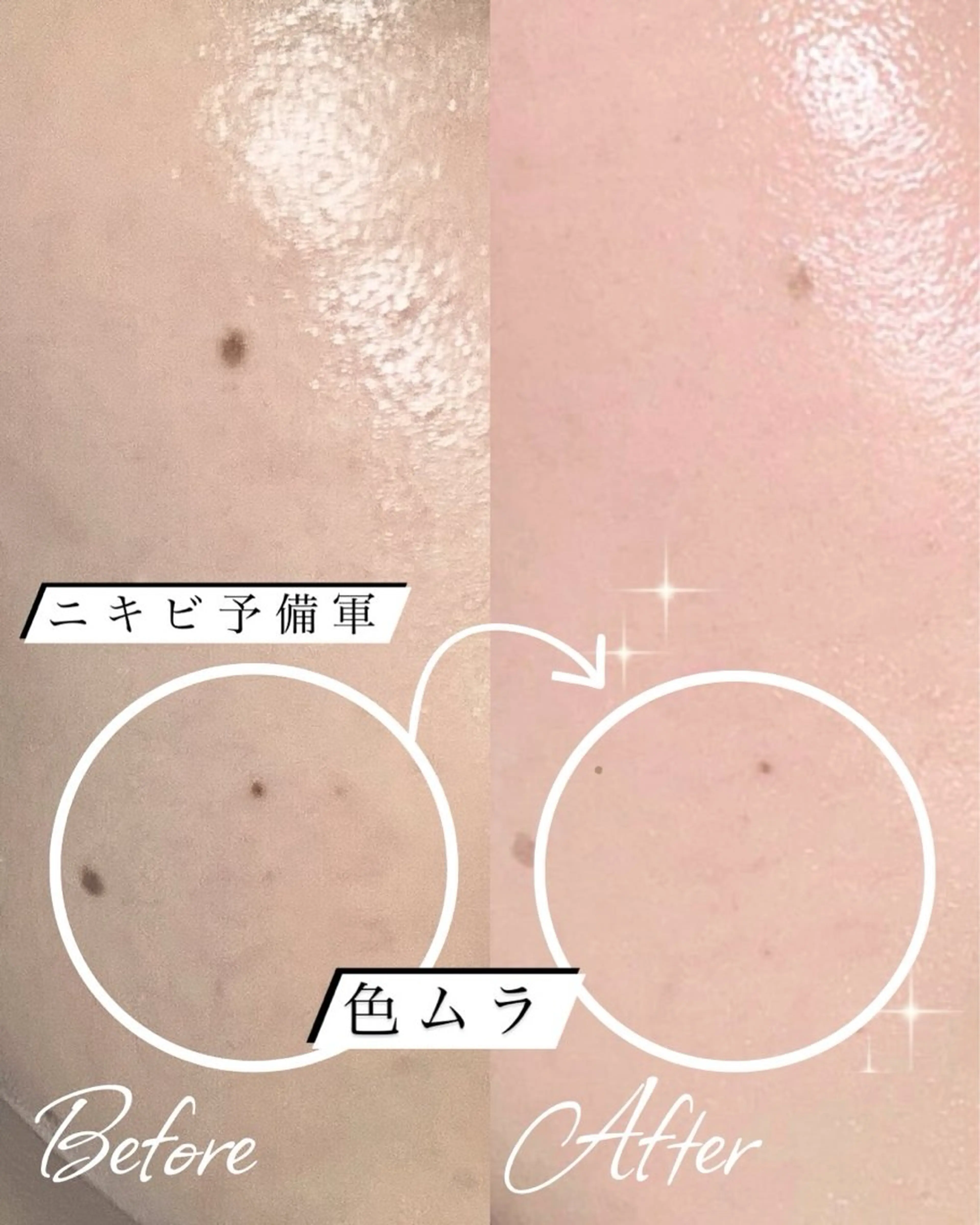 エステ abbellina×UNO出雲塩冶店《ウノ》所属・フェイシャルエステ 🫧琉衣のエステ・リラクイメージ