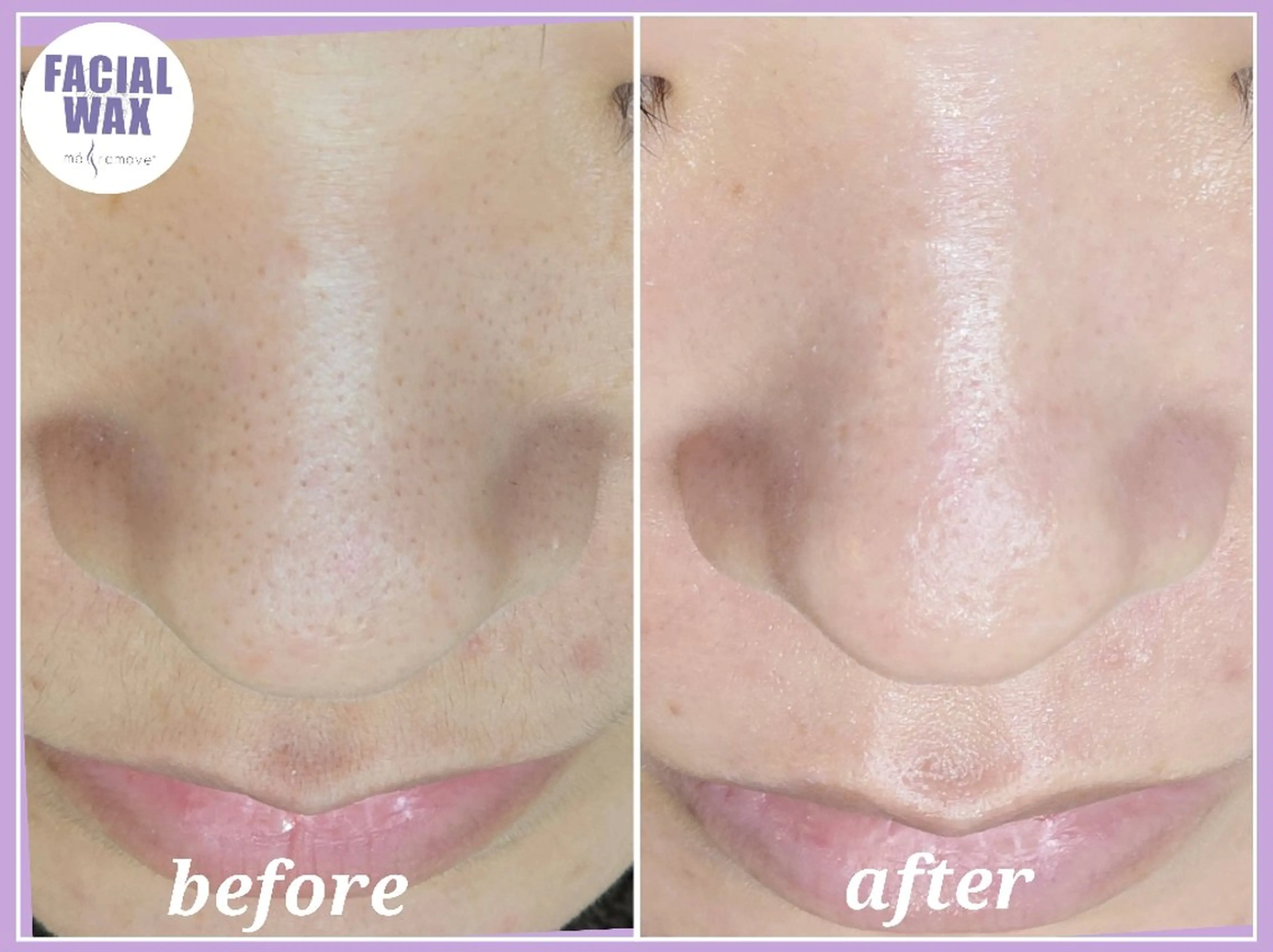 エステ facial salon Lily所属・salon Lilyのエステ・リラクイメージ