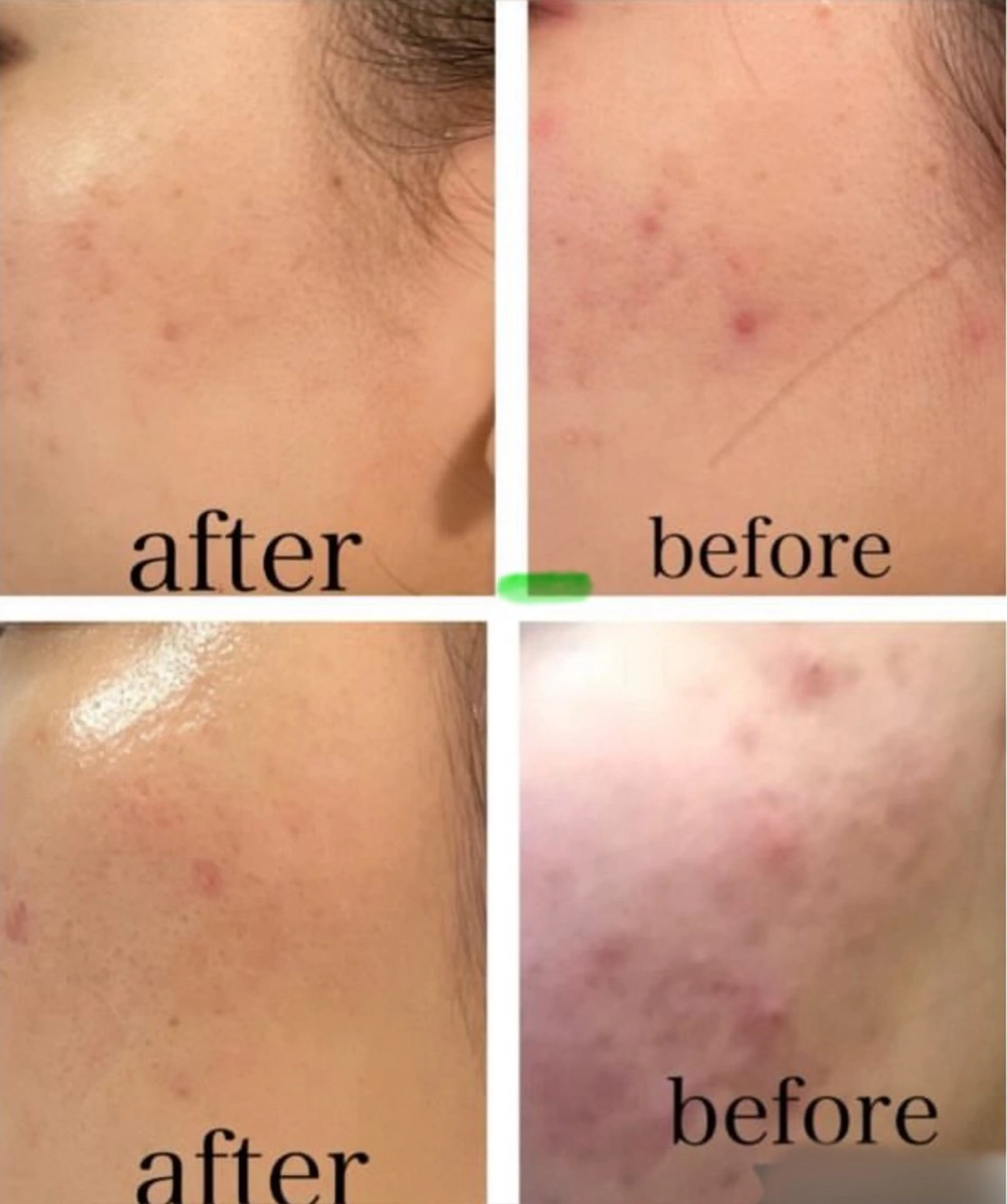 ナリスビューティサロン　デアイム津田沼所属・堀井 敏子のエステ・リラクイメージ