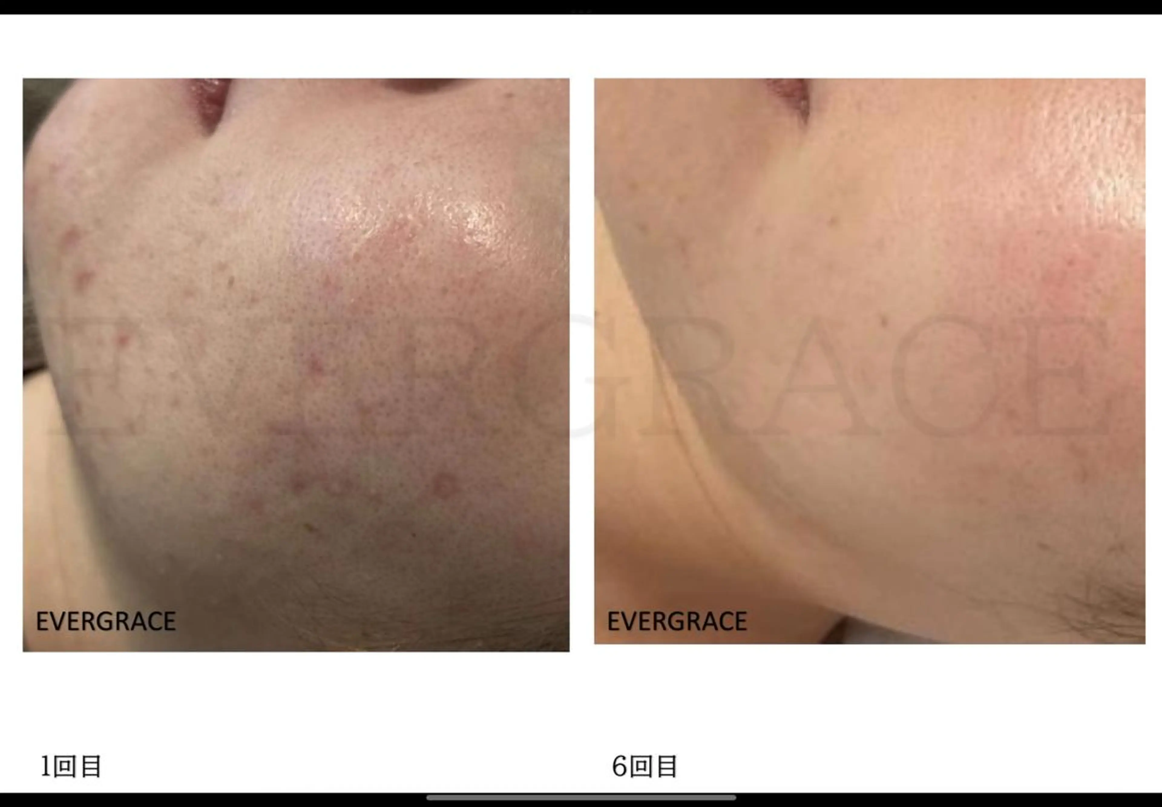 エステ エヴァーグレース 金山店のエステ・リラクイメージ