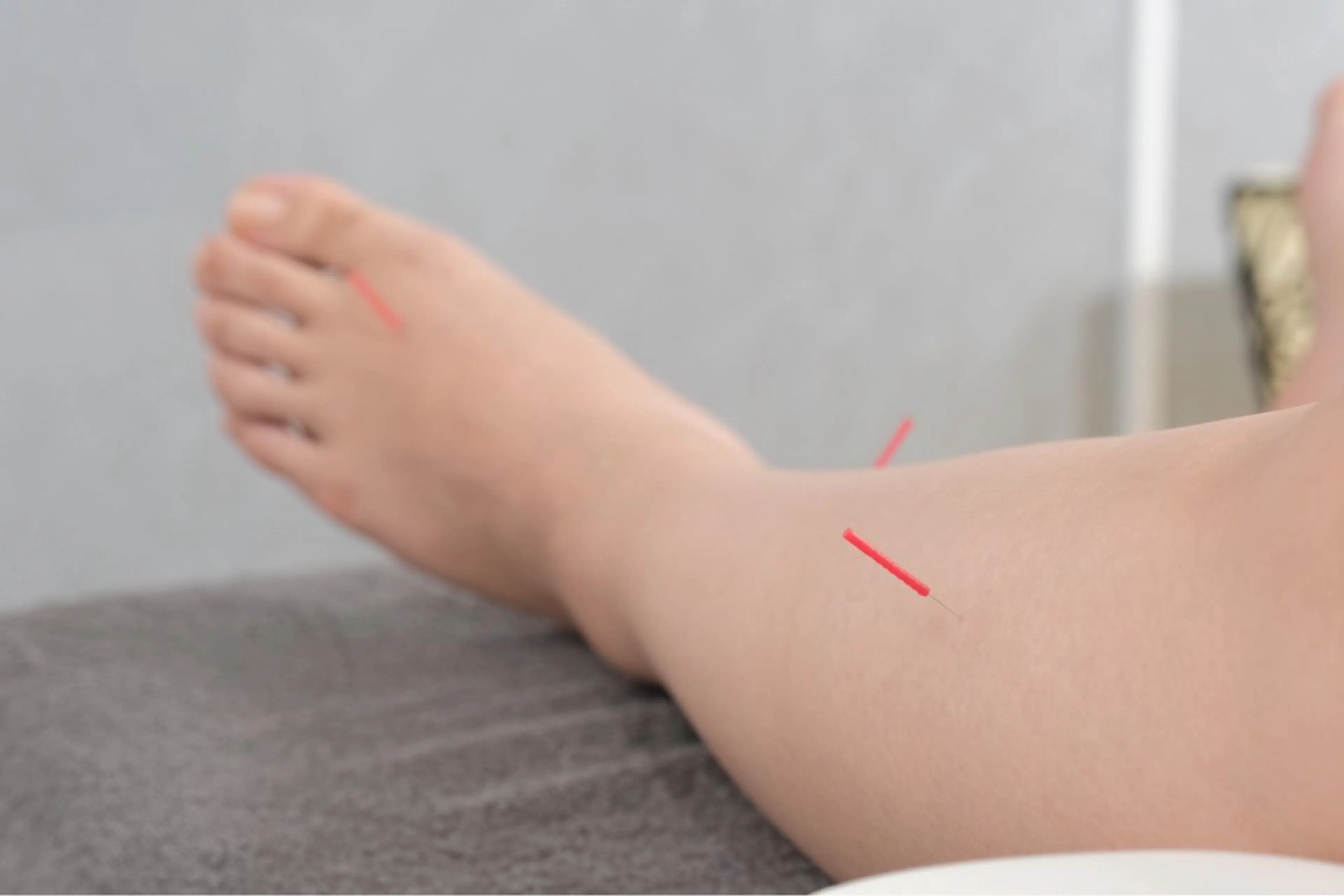 【身体の不調を整える】⭐︎当日のみ限定⭐︎自律神経鍼灸（約60分）初回カウンセリング（30分）➕施術（60分）の写真