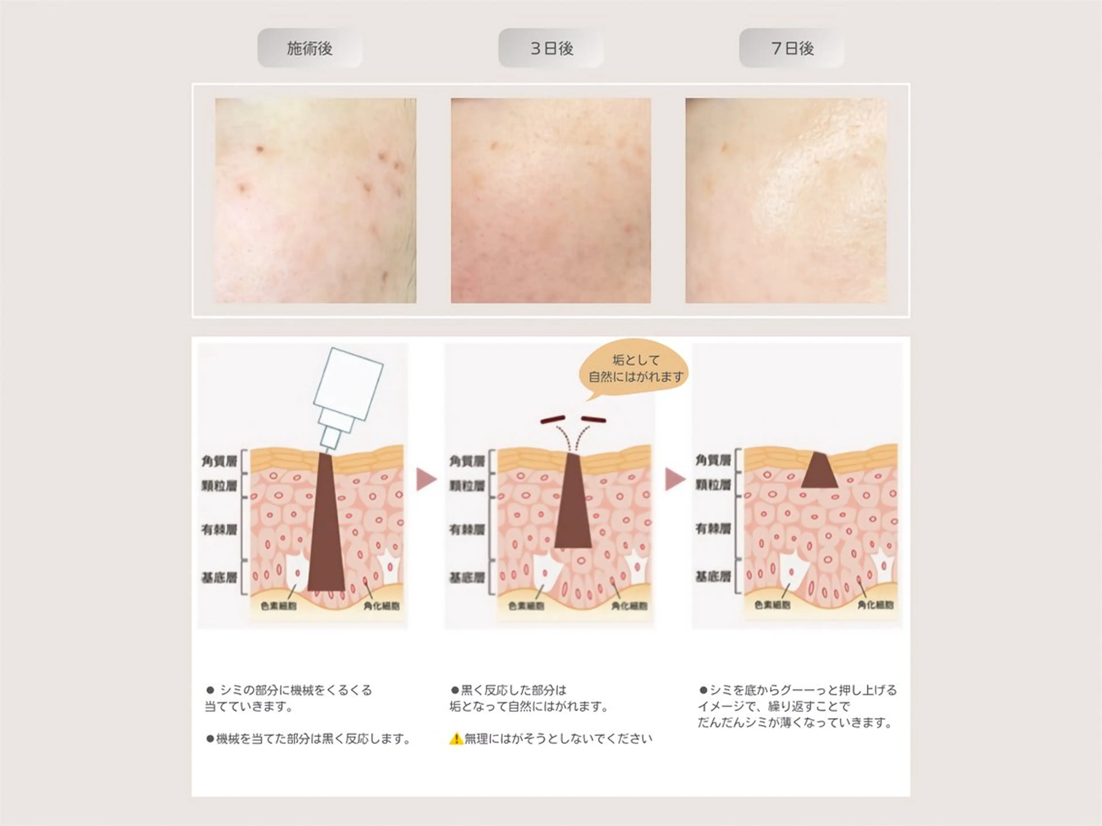 エステ beauty salon milky【ミルキー】所属・milky 【ミルキー】のエステ・リラクイメージ