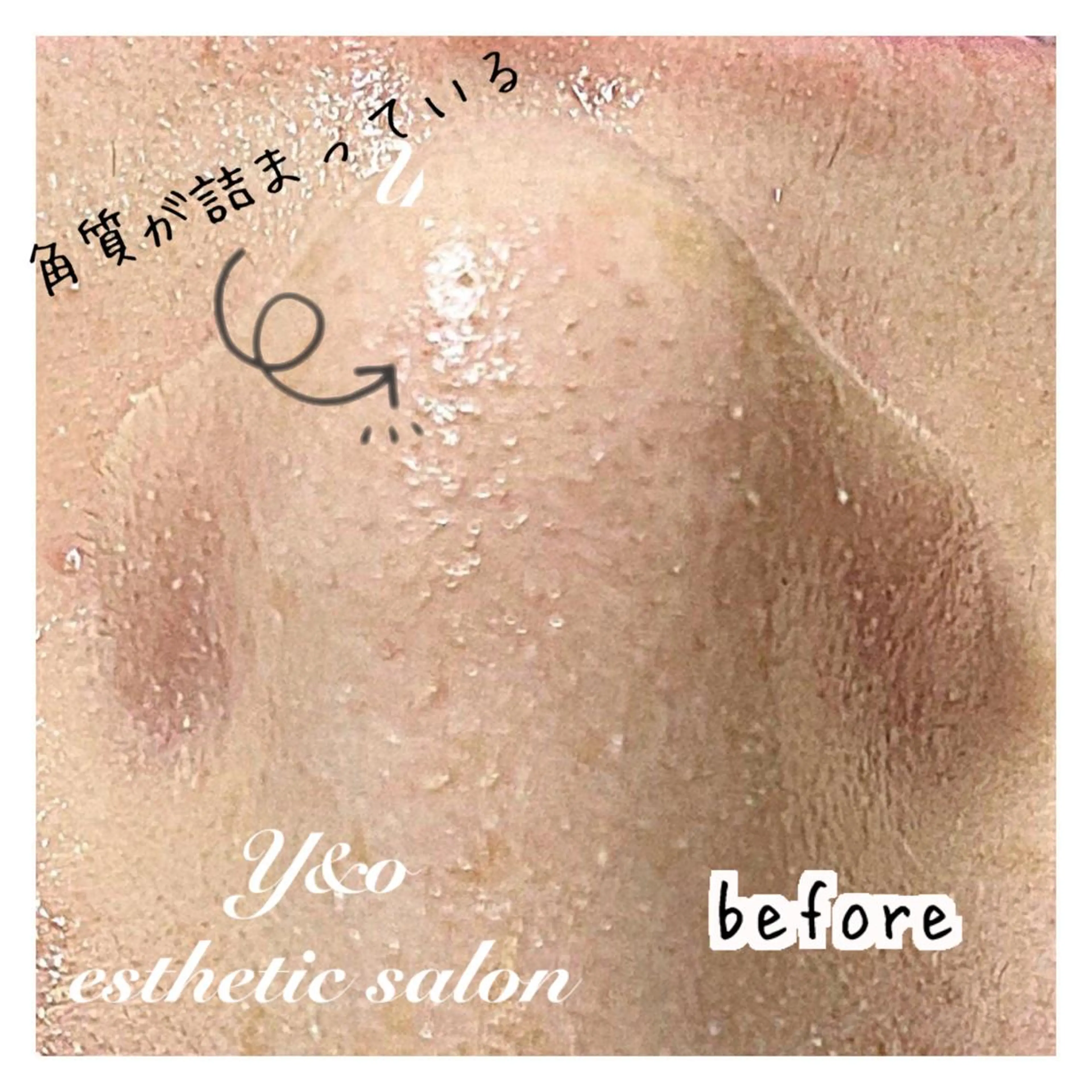 エステ 〜小顔・痩身・リラクゼーション〜　　Y&o Esthetic  Salon所属・HANA MIKIの眉毛・アイブロウイメージ