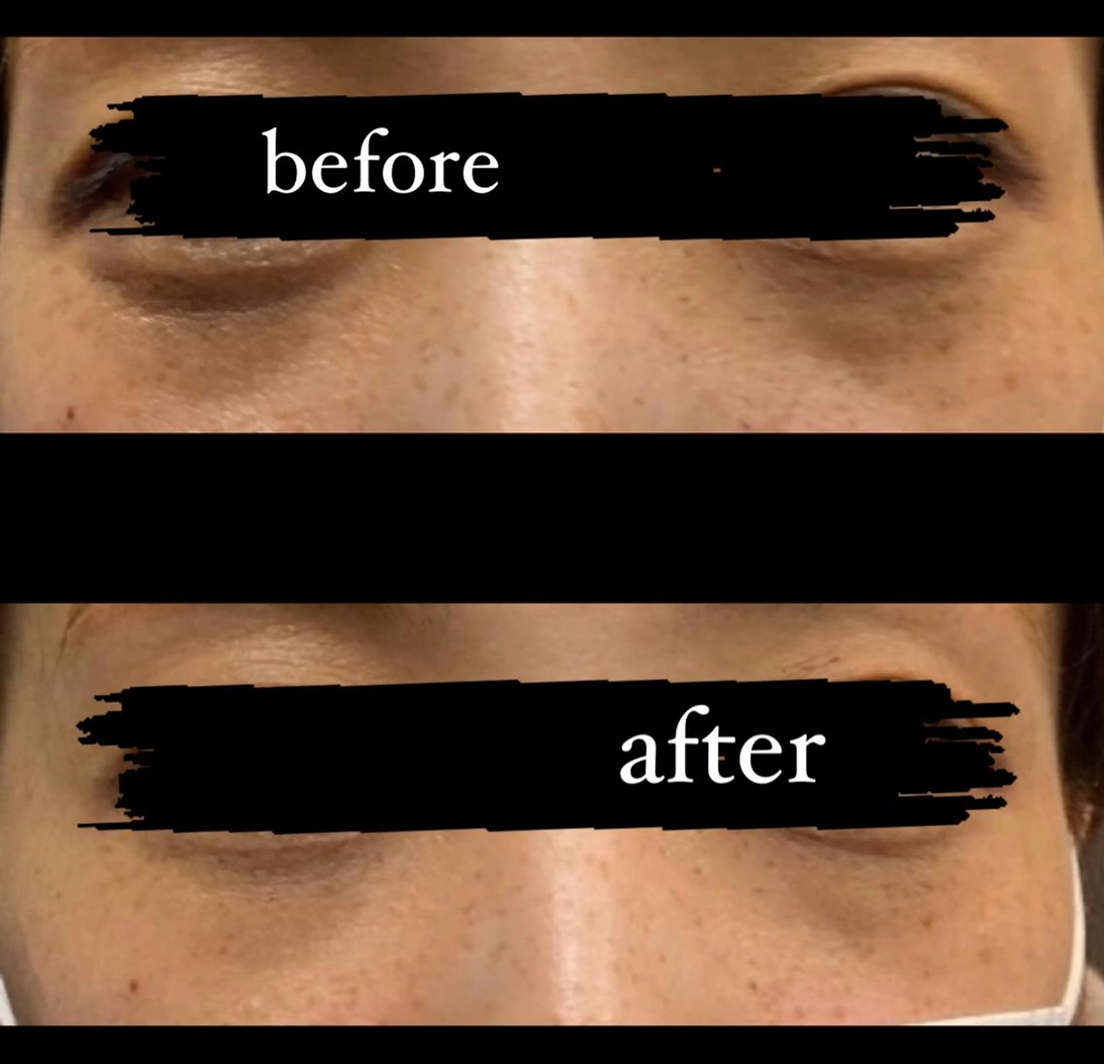 Beauty style +α所属・Memezawa Nanaのネイルデザイン